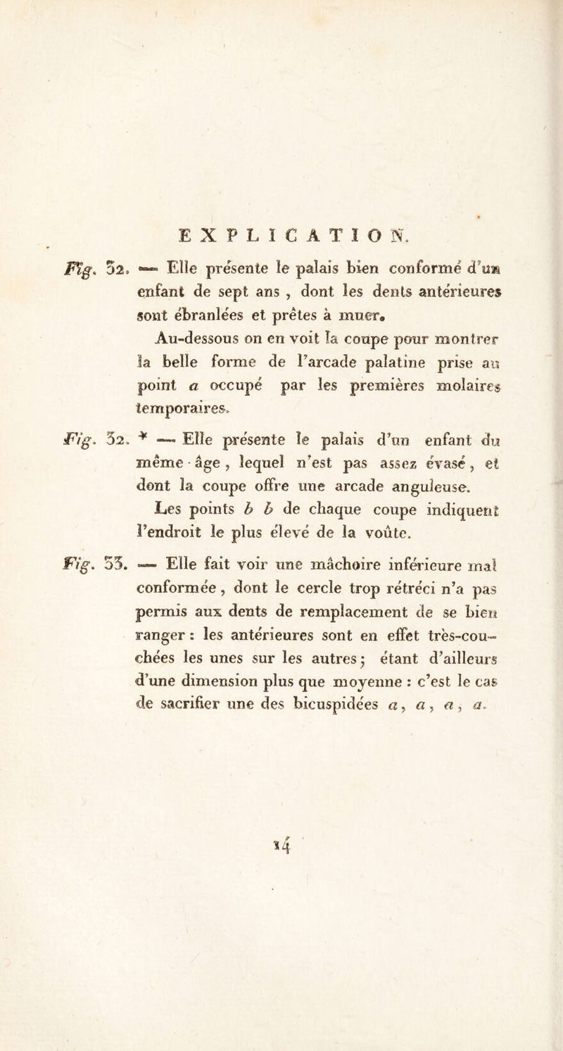 Fïg„ 5s, — Elle présente le palais bien conformé cftm enfant de sept ans , dont les dents antérieures sont ébranlées et prêtes à muer. Au-dessous on en voit la coupe pour montrer la belle forme de l’arcade palatine prise an point a occupé par les premières molaires temporaires, Fig, 52. * —- Elle présente le palais d’un enfant du même âge, lequel n’est pas assez évasé, et dont la coupe offre une arcade anguleuse. Les points b h de chaque coupe indiquent l’endroit le plus élevé de la voûte. Fig. 53. — Elle fait voir une mâchoire inférieure mal conformée, dont le cercle trop rétréci n’a pas permis aux dents de remplacement de se bien ranger : les antérieures sont en effet très-cou- chées les unes sur les autres j étant d’ailleurs d’une dimension plus que moyenne : c’est le cas cle sacrifier une des hicuspidées a, a, a, a.