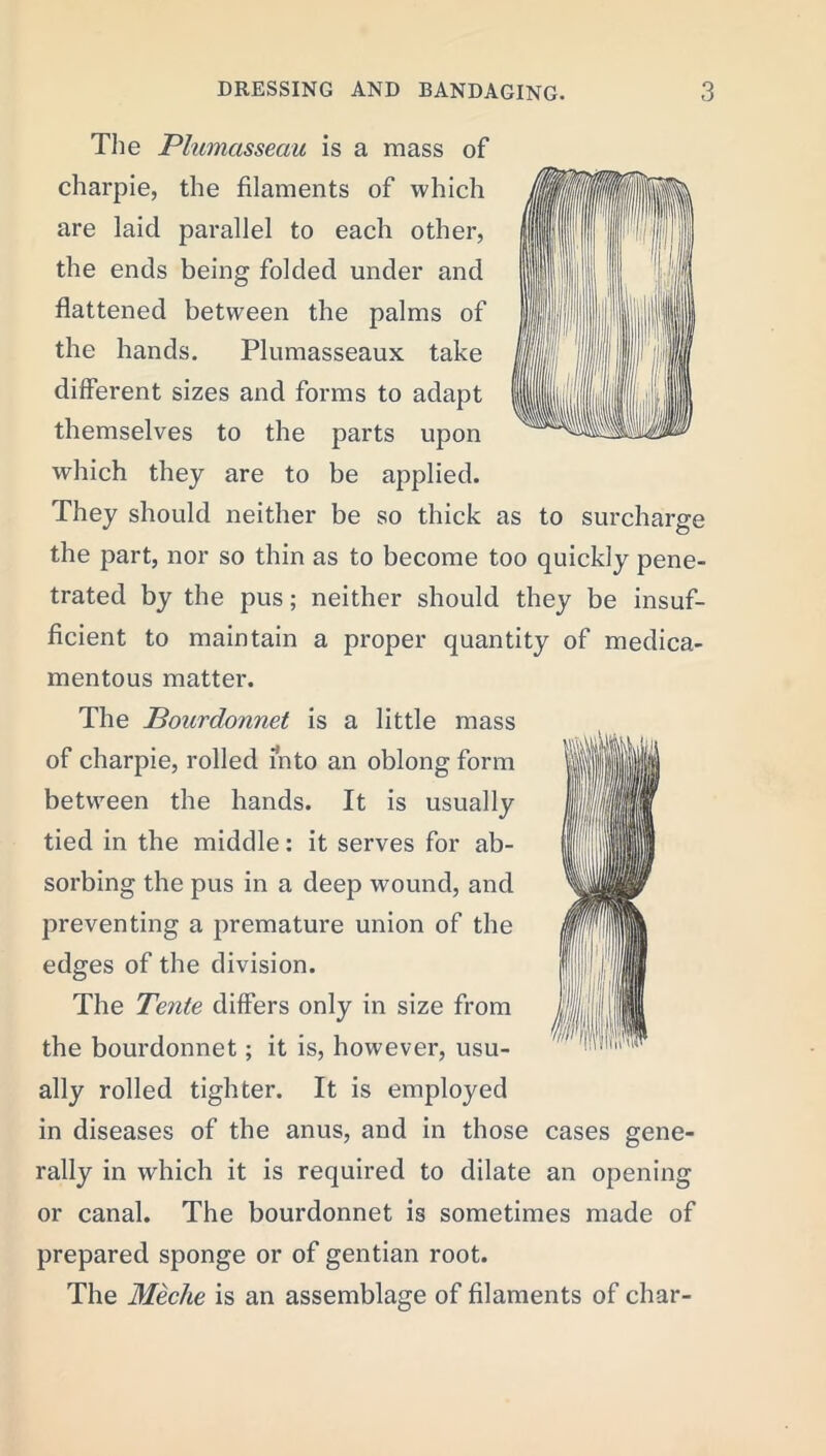 The Plumasseau is a mass of ie, the filaments of which are laid parallel to each other, the ends being folded under and flattened between the palms of the hands. Plumasseaux take different sizes and forms to adapt themselves to the parts upon which they are to be applied. They should neither be so thick as to surcharge the part, nor so thin as to become too quickly pene- trated by the pus; neither should they be insuf- ficient to maintain a proper quantity of medica- mentous matter. The JBourdonnet is a little mass of charpie, rolled into an oblong form between the hands. It is usually tied in the middle: it serves for ab- sorbing the pus in a deep wound, and preventing a premature union of the edges of the division. The Tente differs only in size from the bourdonnet; it is, however, usu- ally rolled tighter. It is employed in diseases of the anus, and in those cases gene- rally in which it is required to dilate an opening or canal. The bourdonnet is sometimes made of prepared sponge or of gentian root. The Meche is an assemblage of filaments of char-