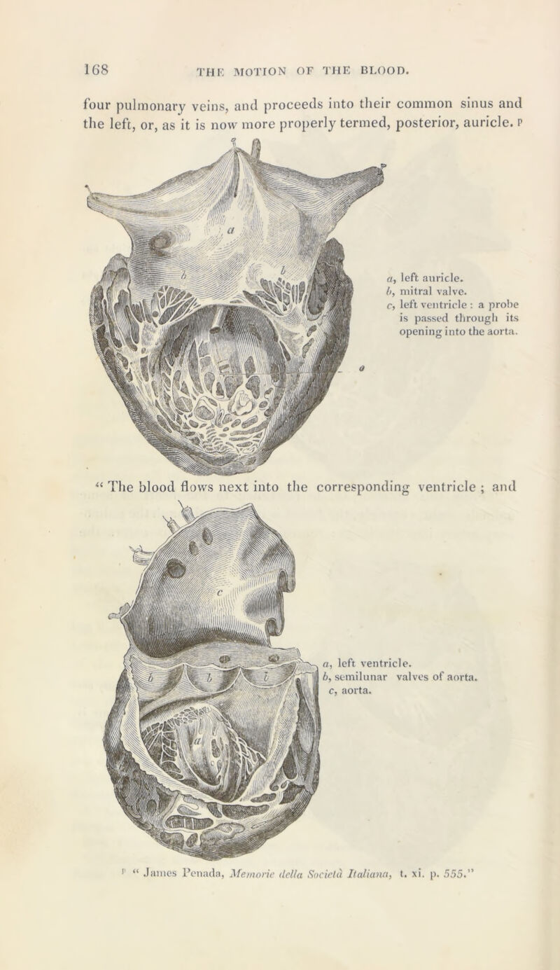 four pulmonary veins, and proceeds into their common sinus and the left, or, as it is now more properly termed, posterior, auricle, p left auricle, mitral valve, left ventricle : a probe is passed through its opening into the aorta. “ The blood flows next into the corresponding ventricle ; and a, left ventricle. b, semilunar valves of aorta, c, aorta. >' “ James Penada, Memorie della Societd Italiana> t. xi, p. 555.”