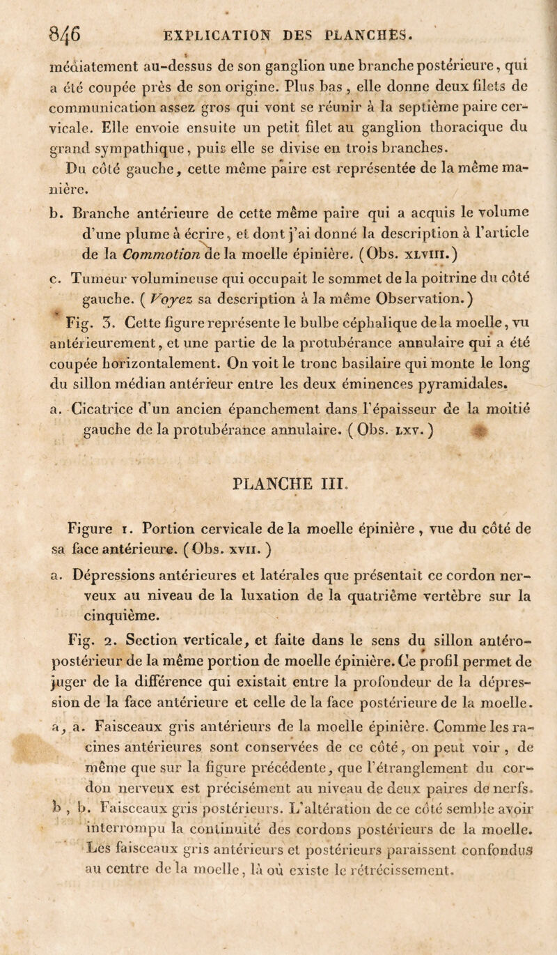« méûiatement au-dessus de son ganglion une branche postérieure, qui a été coupée près de son origine. Plus bas , elle donne deux filets de communication assez gros qui vont se réunir à la septième paire cer¬ vicale. Elle envoie ensuite un petit filet au ganglion thoracique du grand sympathique, puis elle se divise en trois branches. Du coté gauche, cette même paire est représentée de la même ma¬ nière. b. Branche antérieure de cette même paire qui a acquis le volume d’une plume à écrire, et dont j’ai donné la description à l’article de la CommotioT^c\2L moelle épinière. (Obs. XLViii.) c. Tumeur volumineuse qui occupait le sommet de la poitrine du coté gauche. ( Voyez sa description a la même Observation.) Fig. 3. Cette figure représente le bulbe céphalique de la moelle, vu antérieurement, et une partie de la protubérance annulaire qui a été coupée horizontalement. On voit le tronc basilaire qui monte le long du sillon médian antérieur entre les deux éminences pyramidales. a. Cicatrice d’un ancien épanchement dans l’épaisseur de la moitié gauche de la protubérance annulaire. ( Obs. Lxv. ) PLANCHE Iir. Figure i. Portion cervicale de la moelle épinière , vue du côté de sa face antérieure. (Obs. xvii. ) a. Dépressions antérieures et latérales que présentait ce cordon ner¬ veux au niveau de la luxation de la quatrième vertèbre sur la cinquième. Fig. 2. Section verticale, et faite dans le sens du sillon antéro¬ postérieur de la même portion de moelle épinière. Ce profil permet de juger de la différence qui existait entre la profondeur de la dépres¬ sion de la face antérieure et celle de la face postérieure de la moelle. a, a. Faisceaux gris antérieurs de la moelle épinière. Comme les ra¬ cines antérieures sont conservées de ce coté, on peut voir , de même que sur la figure précédente, que l’étranglement du cor¬ don nerveux est précisément au niveau de deux paires de nerfs, b , b. Faisceaux gris postérieurs. L’altération de ce côté seml^le avoir interrompu la continuité des cordons postérieurs de la moelle. Les faisceaux gris antérieurs et postérieurs paraissent confondus au centre de la moelle, là où existe le rétrécissement.