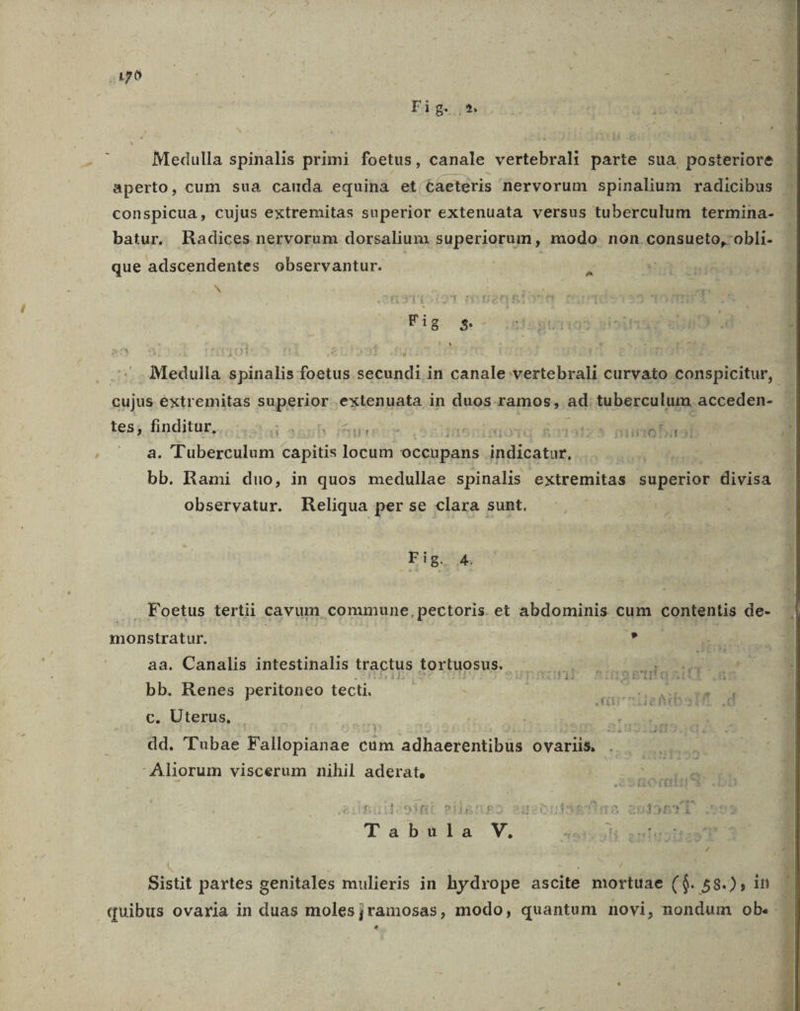 qai o3 | : : ^ Fig. d Medulla spinalis primi foetus, canale vertebrali parte sua posteriore aperto, cum sua canda equina et. taeteris nervorum spinalium radicibus conspicua, cujus extremitas superior extenuata versus tuberculum termina- batur. Radices nervorum dorsalium superiorum, modo. non.consueto,'obli- que adscendentes observantur. b F. .. . Medulla spinalis foetus secundi in canale vertebrali curvato conspicitur, | cujus extremitas superior extenuata in duos ramos, ad tuberculum. acceden- |  a. TTuberculum capitis locum occupans indicatur, tes, finditur, S &amp;but fein bn Hola E1315 ol d E bb. Rami duo, in quos medullae spinalis extremitas superior divisa observatur. Reliqua per se clara sunt. Fig9ta, ... Foetus tertii cavum commune, pectoris. et abdominis cum contentis de- monstratur. ) : | aa. Canalis intestinalis tractus tortuosus. cu ap qi. cs M e j bb. Renes peritoneo tecti. m Ez i —- c, Uterus, . GR | dd. 'Tubae Fallopianae cum adhaerentibüs ovariis. Aliorum viscerum nihil aderat, BM pagiioobr DILE! joouléeTiao 2019671 Tabula V. Asl | : A 4 Sistit partes genitales mulieris in hydrope ascite mortuae ($. 58.) ; in quibus ovaria in duas molesjramosas, modo, quantum novi, nondum ob. á PEEL pu