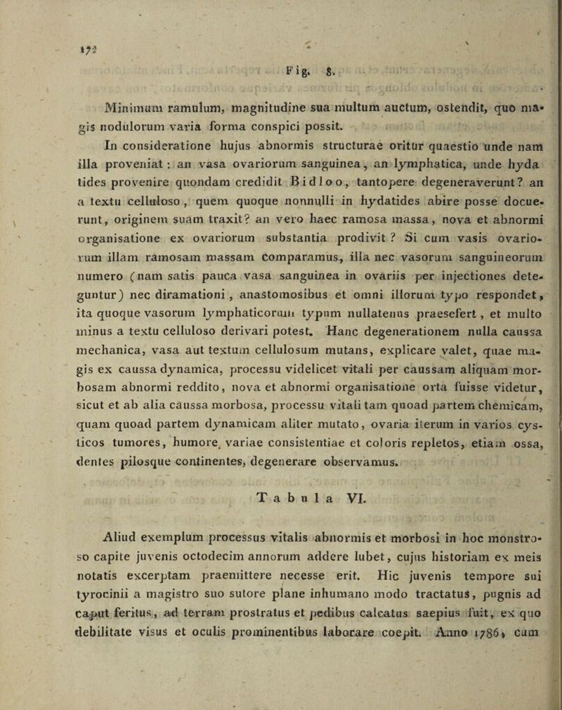 2 Fig 8. Minimum ramulum, magnitudine sua multum auctum, ostendit, quo ma. - sis nodulorum varia forma conspici possit. - do 6l: ust In consideratione hujus abnormis structuraé oritür quaestio unde nam illa proveniat: am vasa ovariorum sanguinea, an:lymphatica, unde hyda. tides provenire: quondam credidit. Bidloo; tantopere degeneraverunt? an a textu celluloso , quem quoque nonnulli-in hydatides abire posse docue- runt, originem suam traxit? an vero haec ramosa massa , noya et abnormi organisatione ex ovariorum substantia prodivit ? Si cum vasis ovario- rum illam. ráàmosam massam Comparamus, illa nec vasorum sanguineorum numero (nam satis pauca.vasá sanguinea in ováriis per injectiones dete. - guntur) nec diramationi , anastomosibus. et omni illorum: typo respondet , ita quoque vasorum lymphaticoruu: typum nullatenus praesefert , et multo minus a textu celluloso derivari potest, Hanc degenerationem nulla caussa | mechanica, vasa aut textum cellulosum mutans, explicare valet, quae ma- gis ex caussa dynamica, processu videlicet vitali per caussam aliquam mor- bosam abnormi reddito, nova et abnormi orgauisatione ortà fuisse videtur, sicut et ab alia caussa morbosa, processu vitali tam quoad partem chémicam, quam quoad partem dynamicam aliter mutato, ovaria iterum in varios cys- icos tumores, humore, variae consistentiae et coloris repletos, etiam ossa, dentes pilosque continentes, degenerare observamus. ) 5 civ Tabula. VI. Aliud exemplum processus vitalis.abnormis et morbosi in hoc monstro- so capite juvenis octodecim annorum addere lubet, cujus historiam ex meis notatis excerptam praenittere necesse erit, Hic juvenis tempore sui tyrocinii a magistro suo sutore plane inhumano modo tractatus, pugnis ad caput feritus, ad terram prostratus et pedibus calcatus saepius'fuit, ex quo debilitate visus et oculis prominentibus laborare.coepit,' Auno 1786, cum