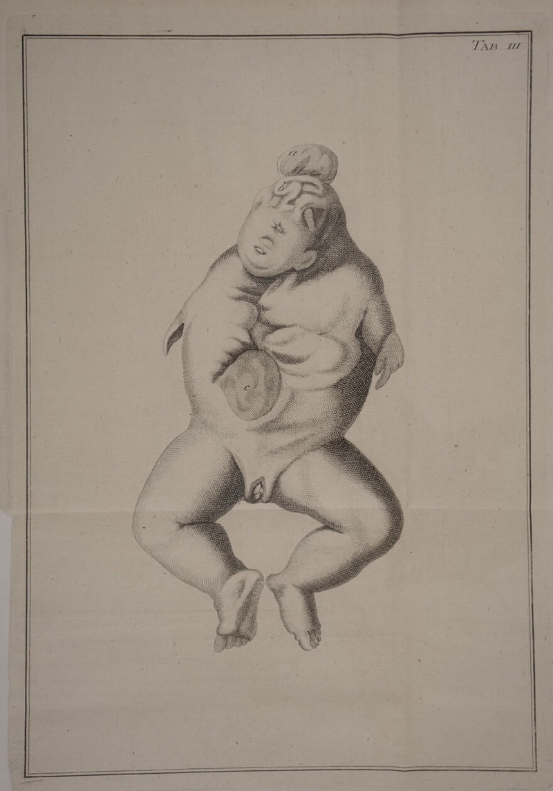 s 2» d ; DEALS ; c 2a b, PHP. S SN NM o me m 2) re x UN XD ANS d Tre Nx AT) NS