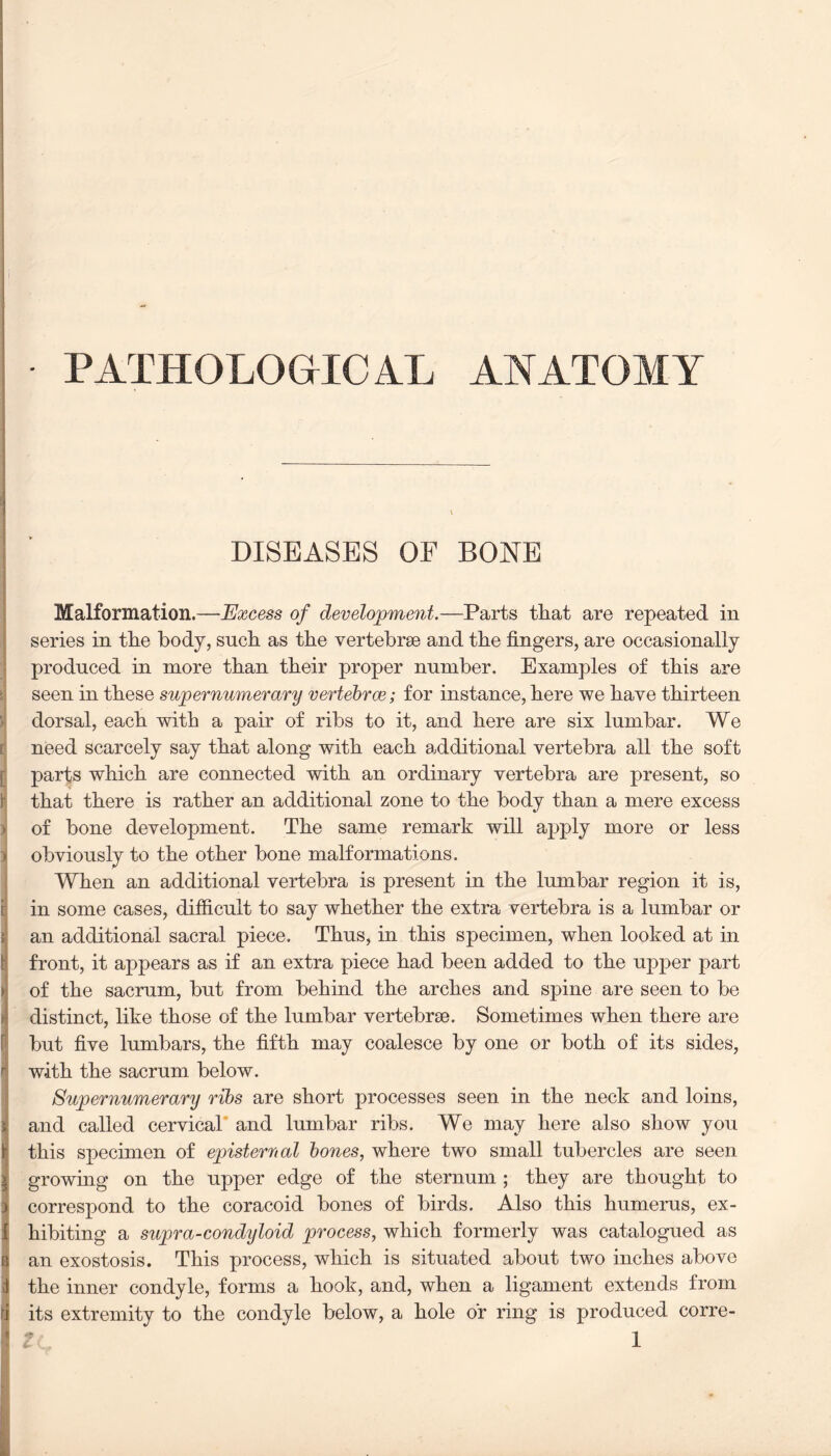 • PATHOLOGICAL ANATOMY 5m i • i \ DISEASES OF BONE Malformation.—Excess of development.—Parts that are repeated in series in the body, such as the vertebrse and the fingers, are occasionally produced in more than their proper number. Examples of this are seen in these supernumerary vertebrae; for instance, here we have thirteen dorsal, each with a pair of ribs to it, and here are six lumbar. We need scarcely say that along with each additional vertebra all the soft parts which are connected with an ordinary vertebra are present, so that there is rather an additional zone to the body than a mere excess i of bone development. The same remark will apply more or less ) obviously to the other bone malformations. When an additional vertebra is present in the lumbar region it is, in some cases, difficult to say whether the extra vertebra is a lumbar or s an additional sacral piece. Thus, in this specimen, when looked at in f front, it appears as if an extra piece had been added to the upper part > of the sacrum, but from behind the arches and spine are seen to be >1 distinct, like those of the lumbar vertebrse. Sometimes when there are but five lumbars, the fifth may coalesce by one or both of its sides, r with the sacrum below. Supernumerary ribs are short processes seen in the neck and loins, i and called cervical and lumbar ribs. We may here also show you 1 this specimen of episterual bones, where two small tubercles are seen j growing on the upper edge of the sternum ; they are thought to 3 correspond to the coracoid bones of birds. Also this humerus, ex- 1 hibiting a supra-condyloid process, which formerly was catalogued as 8 an exostosis. This process, which is situated about two inches above 1 the inner condyle, forms a hook, and, when a ligament extends from li its extremity to the condyle below, a hole or ring is produced corre-