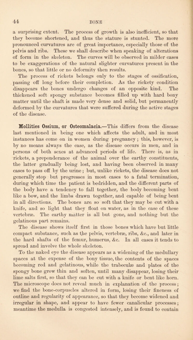 a surprising extent. The process of growth is also inefficient, so that they become shortened, and thus the stature is stunted. The more pronounced curvatures are of great importance, especially those of the pelvis and ribs. These we shall describe when speaking of alterations of form in the skeleton. The curves will be observed in milder cases to be exaggerations of the natural slighter curvatures present in the bones, so that little or no deformity then results. The process of rickets belongs only to the stages of ossification, passing off long before their completion. As the rickety condition disappears the bones undergo changes of an opposite kind. The thickened soft spongy substance becomes filled up with hard bony matter until the shaft is made very dense and solid, but permanently deformed by the curvatures that were suffered during the active stages of the disease. Mollifies Ossium, or Osteomalacia.—This differs from the disease last mentioned in being one which affects the adult, and in most instances has come on in women during pregnancy ; this, however, is by no means always the case, as the disease occurs in men, and in persons of both sexes at advanced periods of life. There is, as in rickets, a preponderance of the animal over the earthy constituents, the latter gradually being lost, and having been observed in many cases to pass off by the urine ; but, unlike rickets, the disease does not generally stop but progresses in most cases to a fatal termination, during which time the patient is bedridden, and the different parts of the body have a tendency to fall together, the body becoming bent like a bow, and the limbs drawn together, and capable of being bent in all directions. The bones are so soft that they may be cut with a knife, and so light that they float on water, as in the case of these vertebrae. The earthy matter is all but gone, and nothing but the gelatinous part remains. The disease shows itself first in those bones which have but little compact substance, such as the pelvis, vertebrae, ribs, <fcc., and later in the hard shafts of the femur, humerus, &c. In all cases it tends to spread and involve the whole skeleton. To the naked eye the disease appears as a widening of the medullary spaces at the expense of the bony tissue, the contents of the spaces becoming red and gelatinous, while the trabeculae and plates of the spongy bone grow thin and soften, until many disappear, losing their lime salts first, so that they can be cut with a knife or bent like horn. The microscope does not reveal much in explanation of the process; we find the bone-corpuscles altered in form, losing their fineness of outline and regularity of appearance, so that they become widened and irregular in shape, and appear to have fewer canalicular processes; meantime the medulla is congested intensely, and is found to contain