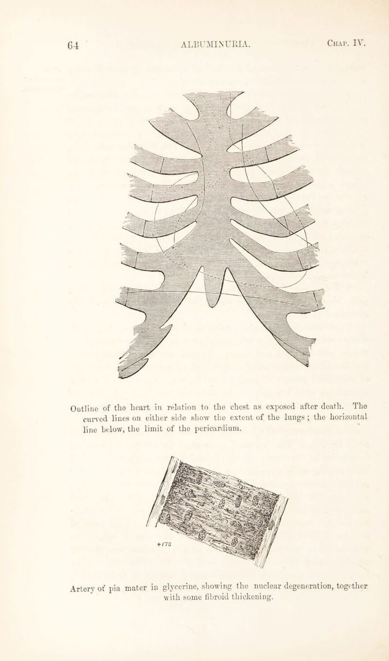 Outline of the heart in relation to the chest as exposed after death. The curved lines on either side show the extent of the lungs ; the horizontal line below, the limit of the pericardium. Artery of pia mater in glycerine, showing the nuclear degeneration, together with some fibroid thickening.