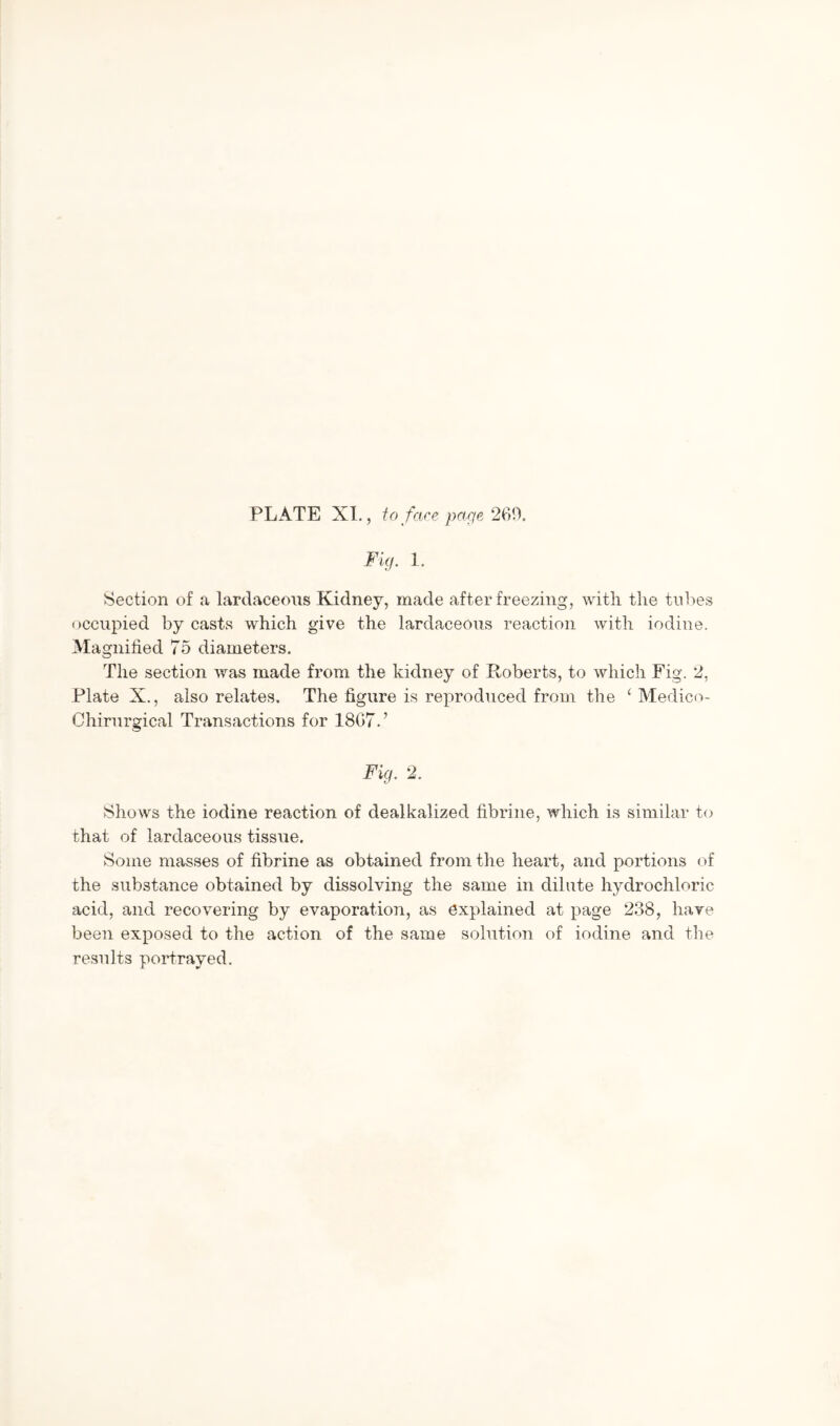 PLATE XI., to face page 269. Fig. 1. Section of a lardaceous Kidney, made after freezing, with the tubes occupied by casts which give the lardaceous reaction with iodine. Magnified 75 diameters. The section was made from the kidney of Roberts, to which Fig. 2, Plate X., also relates. The figure is reproduced from the ‘ Medico- Chirurgical Transactions for 1867.’ Fig. 2. Shows the iodine reaction of dealkalized fibrine, which is similar to that of lardaceous tissue. Some masses of fibrine as obtained from the heart, and portions of the substance obtained by dissolving the same in dilute hydrochloric acid, and recovering by evaporation, as explained at page 238, have been exposed to the action of the same solution of iodine and the results portrayed.