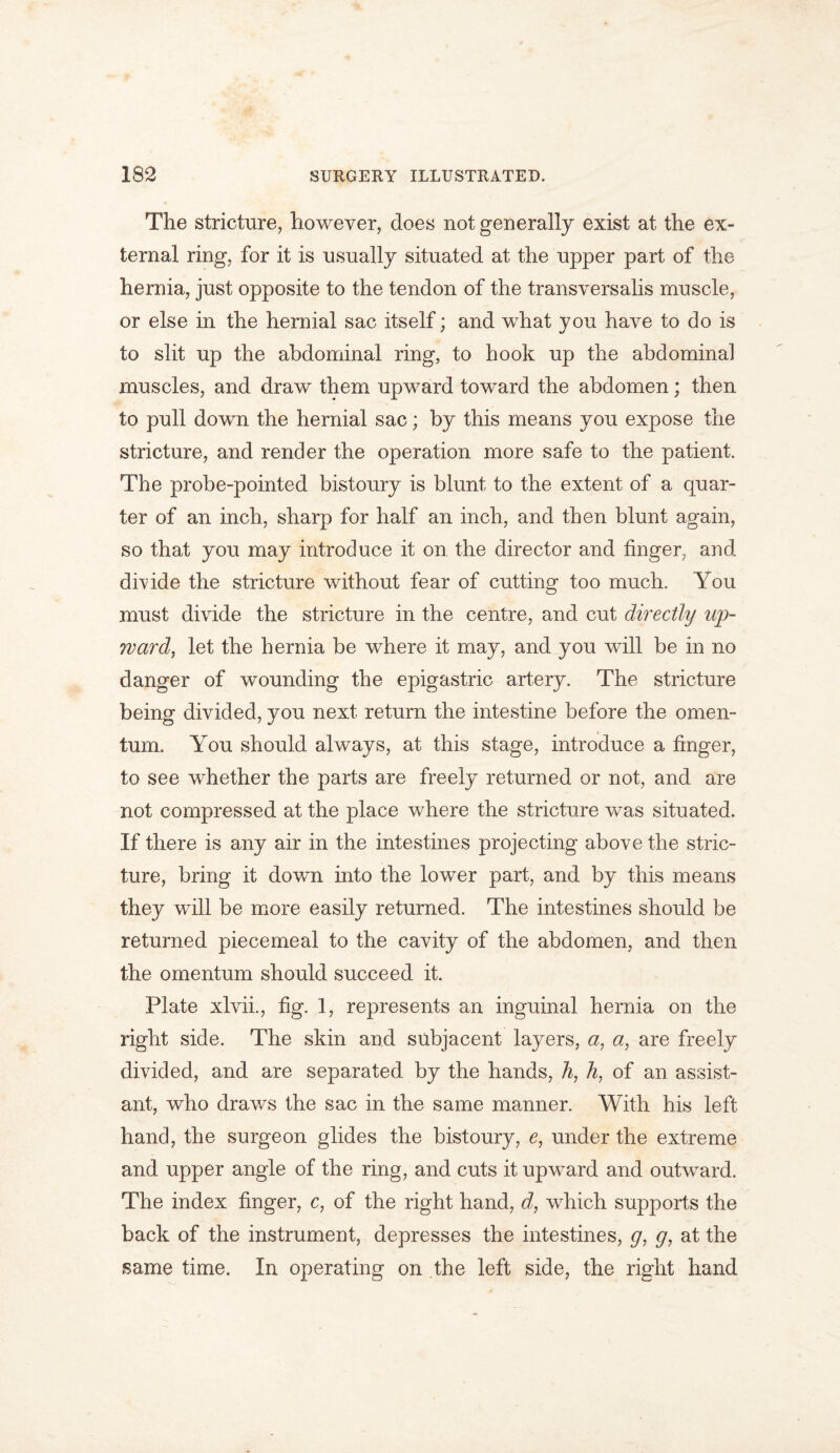 The stricture, however, does not generally exist at the ex- ternal ring, for it is usually situated at the upper part of the hernia, just opposite to the tendon of the transversalis muscle, or else in the hernial sac itself; and what you have to do is to slit up the abdominal ring, to hook up the abdominal muscles, and draw them upward toward the abdomen; then to pull down the hernial sac; by this means you expose the stricture, and render the operation more safe to the patient. The probe-pointed bistoury is blunt to the extent of a quar- ter of an inch, sharp for half an inch, and then blunt again, so that you may introduce it on the director and finger, and divide the stricture without fear of cutting too much. You must divide the stricture in the centre, and cut directly up- ward, let the hernia be where it may, and you will be in no danger of wounding the epigastric artery. The stricture being divided, you next return the intestine before the omen- tum. You should always, at this stage, introduce a finger, to see whether the parts are freely returned or not, and are not compressed at the place where the stricture was situated. If there is any air in the intestines projecting above the stric- ture, bring it down into the lower part, and by this means they will be more easily returned. The intestines should be returned piecemeal to the cavity of the abdomen, and then the omentum should succeed it. Plate xlvii., fig. 1, represents an inguinal hernia on the right side. The skin and subjacent layers, a, a, are freely divided, and are separated by the hands, h, h, of an assist- ant, who draws the sac in the same manner. With his left hand, the surgeon glides the bistoury, e, under the extreme and upper angle of the ring, and cuts it upward and outward. The index finger, c, of the right hand, d, which supports the back of the instrument, depresses the intestines, g, g, at the same time. In operating on the left side, the right hand