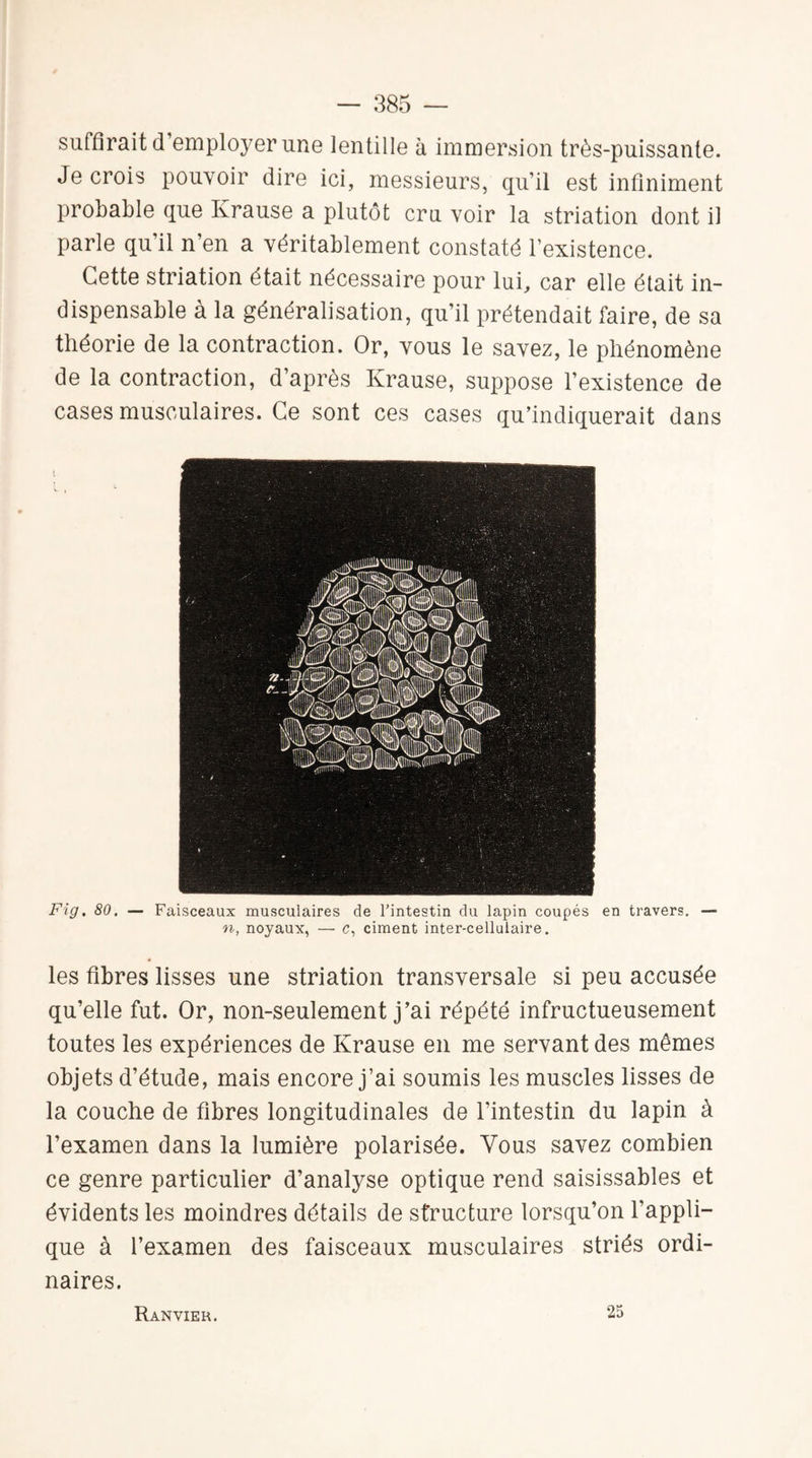 suffirait d employer une lentille à immersion très-puissante. Je crois pouvoir dire ici, messieurs, qu’il est infiniment probable que Krause a plutôt cru voir la striation dont il parle qu’il n’en a véritablement constaté l’existence. Cette striation était nécessaire pour lui, car elle était in¬ dispensable à la généralisation, qu’il prétendait faire, de sa théorie de la contraction. Or, vous le savez, le phénomène de la contraction, d’après Krause, suppose l’existence de cases musculaires. Ce sont ces cases qu’indiquerait dans Fig. 80. — Faisceaux musculaires de l’intestin du lapin coupés en travers. — n, noyaux, — c, ciment inter-cellulaire. les fibres lisses une striation transversale si peu accusée qu’elle fut. Or, non-seulement j’ai répété infructueusement toutes les expériences de Krause en me servant des mêmes objets d’étude, mais encore j’ai soumis les muscles lisses de la couche de fibres longitudinales de l'intestin du lapin à l’examen dans la lumière polarisée. Vous savez combien ce genre particulier d’analyse optique rend saisissables et évidents les moindres détails de structure lorsqu’on l’appli¬ que à l’examen des faisceaux musculaires striés ordi¬ naires. Ranvier. 25