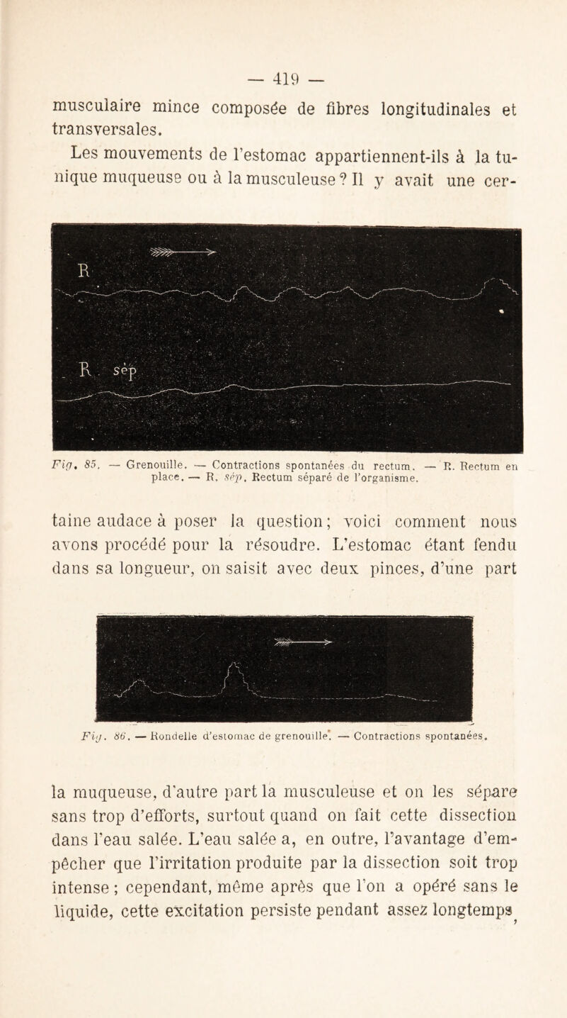 musculaire mince composée de fibres longitudinales et transversales. Les mouvements de l’estomac appartiennent-ils à la tu¬ nique muqueuse ou à la musculeuse ? Il y avait une cer- Fig. 85. — Grenouille. — Contractions spontanées du rectum. — R. Rectum en place. — R. sép. Rectum séparé de l’organisme. taine audace à poser la question ; voici comment nous avons procédé pour la résoudre. L’estomac étant fendu dans sa longueur, on saisit avec deux pinces, d’une part la muqueuse, d autre part la musculeuse et on les sépare sans trop d’efforts, surtout quand on fait cette dissection dans l'eau salée. L’eau salée a, en outre, l’avantage d’em¬ pêcher que l’irritation produite par la dissection soit trop intense ; cependant, même après que l’on a opéré sans le liquide, cette excitation persiste pendant asse2 longtemps