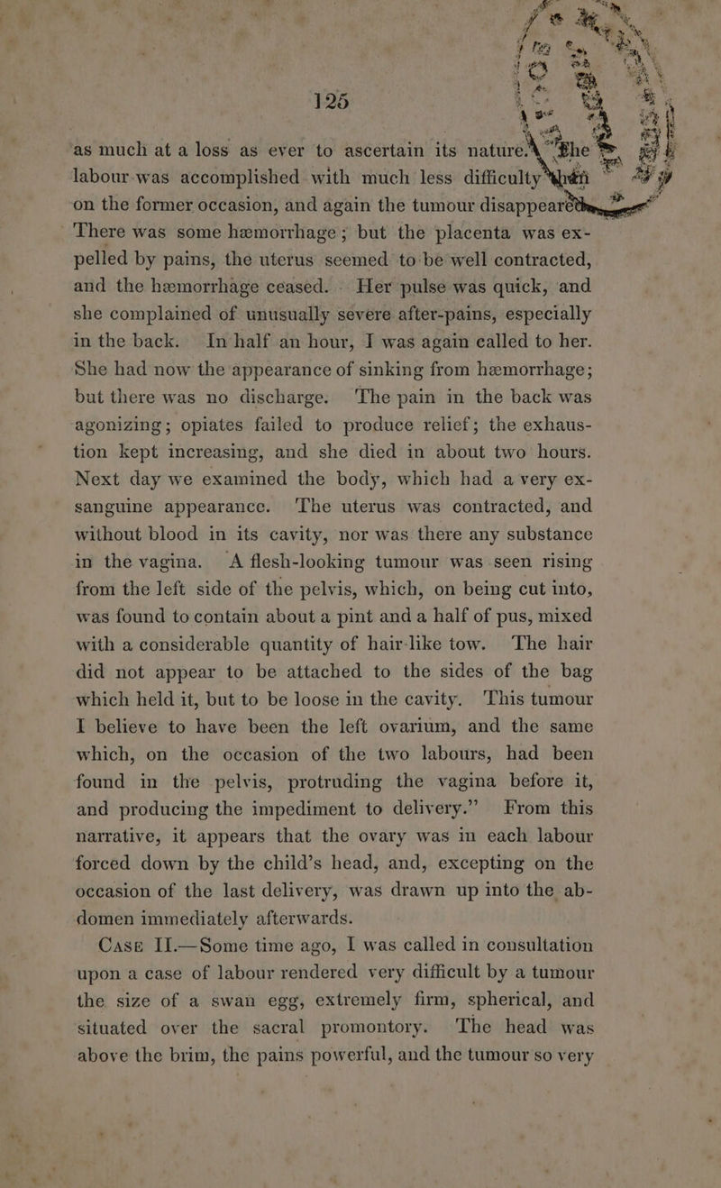 as much at a loss as ever to ascertain its niattire A? sill gt labour.-was accomplished with much less difficulty shen LS AF 6 on the former occasion, and again the tumour disappearethe, 8 ae There was some hemorrhage; but the placenta was ex- ; pelled by pains, the uterus seemed to be well contracted, and the hemorrhage ceased. . Her pulse was quick, and she complained of unusually severe after-pains, especially in the back. In half an hour, I was again called to her. She had now the appearance of sinking from hemorrhage; but there was no discharge. The pain in the back was agonizing; opiates failed to produce relief; the exhaus- tion kept increasing, and she died in about two hours. Next day we examined the body, which had a very ex- sanguine appearance. ‘The uterus was contracted, and without blood in its cavity, nor was there any substance in the vagina. A flesh-looking tumour was seen rising from the left side of the pelvis, which, on being cut into, was found to contain about a pint and a half of pus, mixed with a considerable quantity of hair-like tow. The hair did not appear to be attached to the sides of the bag which held it, but to be loose in the cavity. This tumour I believe to have been the left ovarium, and the same which, on the occasion of the two labours, had been found in the pelvis, protruding the vagina before it, and producing the impediment to delivery.” From this narrative, it appears that the ovary was in each labour forced down by the child’s head, and, excepting on the occasion of the last delivery, was drawn up into the ab- domen immediately afterwards. Case II.—Some time ago, I was called in consultation upon a case of labour rendered very difficult by a tumour the size of a swan egg, extremely firm, spherical, and situated over the sacral promontory. The head was above the brim, the pains powerful, and the tumour so very