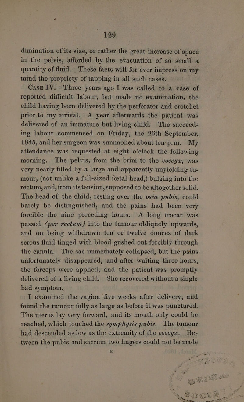 diminution of its size, or rather the great increase of space in the pelvis, afforded by the evacuation of so small a quantity of fluid. These facts will for ever impress on my mind the propriety of tapping in all such cases. | Case 1V.—Three years ago I was called to a case of reported difficult labour, but made no examination, the child having been delivered by the perforator and crotchet prior to my arrival. A year afterwards the patient was delivered of an immature but living child. The succeed- ing labour commenced on Friday, the 26th September, 1835, and her surgeon was summoned about ten-p.m. My attendance was requested at eight o’clock the following morning. The pelvis, from the brim to the coccyx, was very nearly filled by a large and apparently unyielding tu- mour, (not unlike a full-sized fcetal head,) bulging into the rectum, and, from its tension, supposed to be altogether solid. The head of the child, resting over the ossa pubis, could barely be distinguished, and the pains had been very forcible the nine preceding hours. A long trocar was passed (per rectum) into the tumour obliquely upwards, and on being withdrawn ten or twelve ounces of dark serous fluid tinged with blood gushed out forcibly through the canula. ‘The sac immediately collapsed, but the pains unfortunately disappeared, and after waiting three hours, the forceps were applied, and the patient was promptly delivered of a living child. She recovered without a single bad symptom. | I examined the vagina five weeks after delivery, and found the tumour fully as large as before it was punctured. The uterus lay very forward, and its mouth only could be reached, which touched the symphysis pubis. ‘The tumour had descended as low as the extremity of the coccyx. Be- tween the pubis and sacrum two fingers could not be made R