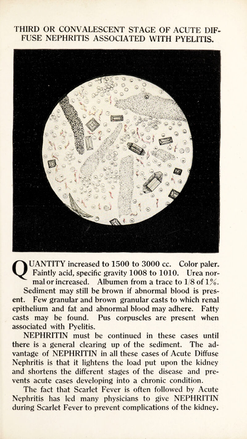 THIRD OR CONVALESCENT STAGE OF ACUTE DIF¬ FUSE NEPHRITIS ASSOCIATED WITH PYELITIS. QUANTITY increased to 1500 to 3000 cc. Color paler. Faintly acid, specific gravity 1008 to 1010. Urea nor¬ mal or increased. Albumen from a trace to 1/8 of 1%. Sediment may still be brown if abnormal blood is pres¬ ent. Few granular and brown granular casts to which renal epithelium and fat and abnormal blood may adhere. Fatty casts may be found. Pus corpuscles are present when associated with Pyelitis. NEPHRITIN must be continued in these cases until there is a general clearing up of the sediment. The ad¬ vantage of NEPHRITIN in all these cases of Acute Diffuse Nephritis is that it lightens the load put upon the kidney and shortens the different stages of the disease and pre¬ vents acute cases developing into a chronic condition. The fact that Scarlet Fever is often followed by Acute Nephritis has led many physicians to give NEPHRITIN during Scarlet Fever to prevent complications of the kidney.