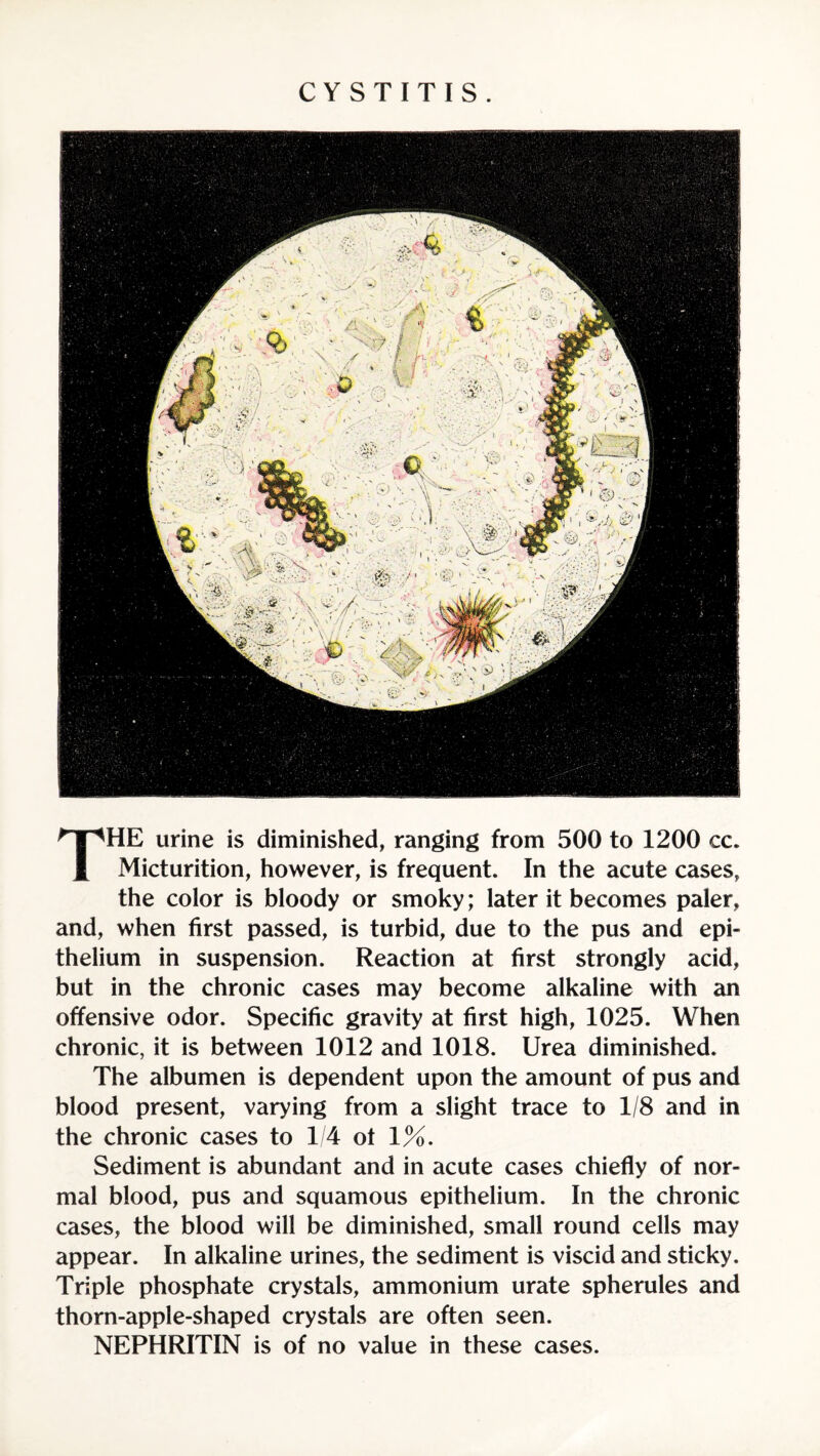 CYSTITIS. THE urine is diminished, ranging from 500 to 1200 cc. Micturition, however, is frequent. In the acute cases, the color is bloody or smoky; later it becomes paler, and, when first passed, is turbid, due to the pus and epi¬ thelium in suspension. Reaction at first strongly acid, but in the chronic cases may become alkaline with an offensive odor. Specific gravity at first high, 1025. When chronic, it is between 1012 and 1018. Urea diminished. The albumen is dependent upon the amount of pus and blood present, varying from a slight trace to 1/8 and in the chronic cases to 1/4 of 1%. Sediment is abundant and in acute cases chiefly of nor¬ mal blood, pus and squamous epithelium. In the chronic cases, the blood will be diminished, small round cells may appear. In alkaline urines, the sediment is viscid and sticky. Triple phosphate crystals, ammonium urate spherules and thorn-apple-shaped crystals are often seen. NEPHRITIN is of no value in these cases.