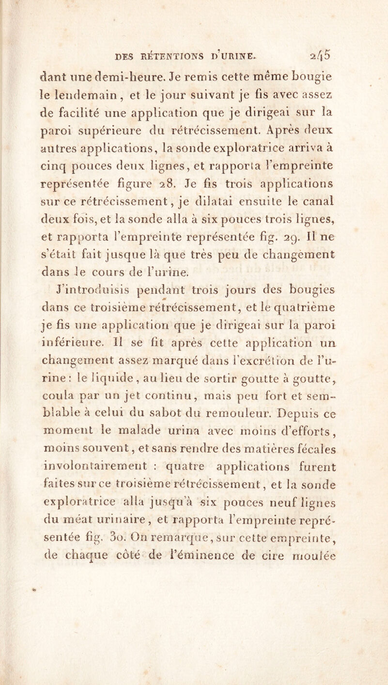 dant une demi-heure. Je remis cette meme bougie le lendemain, et le jour suivant je fis avec assez de facilité une application que je dirigeai sur la paroi supérieure du rétrécissement. Après deux autres applications, la sonde exploratrice arriva à cinq pouces deux lignes, et rapporta l’empreinte représentée figure 28. Je fis trois applications sur ce rétrécissement, je dilatai ensuite le canal deux fois, et la sonde alla à six pouces trois lignes, et rapporta l’empreinte représentée fig. 29. Il ne s’était fait jusque là que très peu de changèment dans le cours de l’urine. J’introduisis pendant trois jours des bougies dans ce troisième rétrécissement, et le quatrième je fis une application que je dirigeai sur la paroi inférieure. Il se fit après cette application un changement assez marqué dans l’excrétion de Vu- rine : le liquide , au lieu de sortir goutte à goutte, coula par un jet continu, mais peu fort et sem- blable à celui du sabot du rémouleur. Depuis ce moment le malade urina avec moins d’efforts, moins souvent, et sans rendre des matières fécales involontairement : quatre applications furent faites sur ce troisième rétrécissement, et la sonde exploratrice alla jusqo’à six pouces neuf lignes du méat urinaire, et rapporta l’empreinte repré- sentée f]g, 3o. On remarcpie, sur cette empreirite, de chaque côté de l’éminence de cire rnoulée