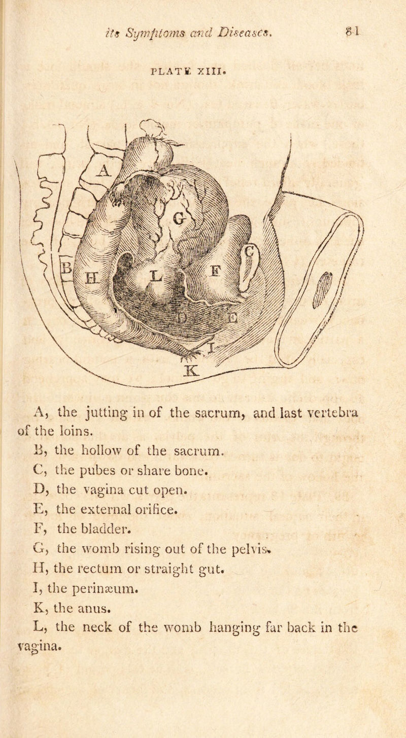 PLATE XIII. A, the jutting in of the sacrum, and last vertebra of the loins. 13, the hollow of the sacrum. C, the pubes or share bone. D, the vagina cut open. E, the external orifice. F, the bladder. G, the womb rising out of the pelvis^ H, the rectum or straight gut. I, the perin^cum. K, the anus. L, the neck of the womb hanging far back in the vagina.