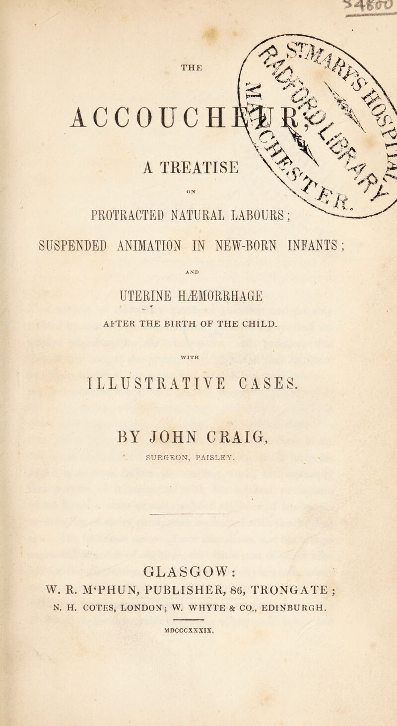 UTERINE HAEMORRHAGE AFTER THE BIRTH OF THE CHILD. WITH ILLUSTRATIVE CASES. BY JOHN CRAIG, SURGEON, PAISLEY. GLASGOW: W. R. M‘PHUN, PUBLISHER, 86, TRONGATE ; N. H. COTES, LONDON; W. WHYTE & CO., EDINBURGH. MDCCCXXXIX.