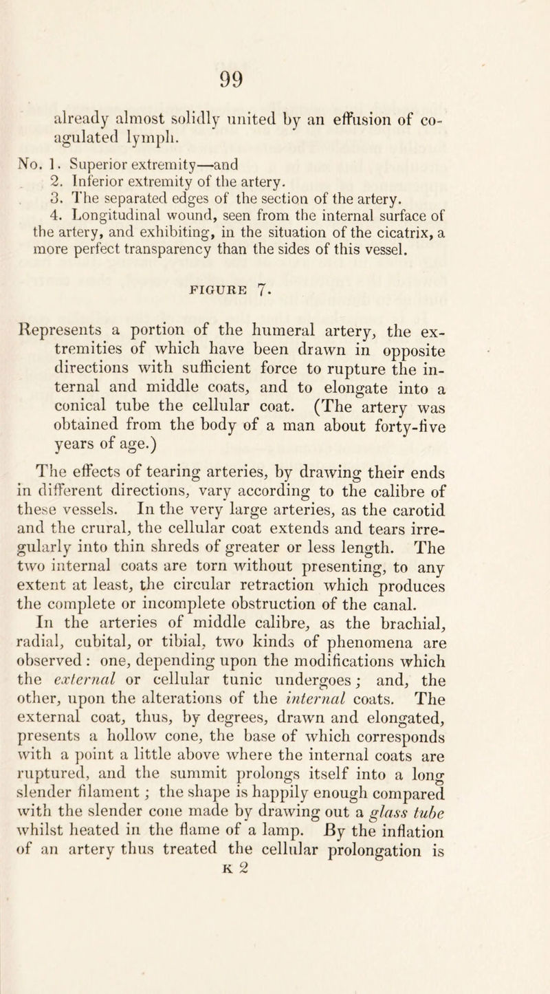 already almost solidly united by an effusion of co- agulated lymph. No. 1. Superior extremity—and 2. Inferior extremity of the artery. 3. The separated edges of the section of the artery. 4. Longitudinal wound, seen from the internal surface of the artery, and exhibiting, in the situation of the cicatrix, a more perfect transparency than the sides of this vessel. FIGURE 7- Represents a portion of the humeral artery, the ex- tremities of which have been drawn in opposite directions with sufficient force to rupture the in- ternal and middle coats, and to elongate into a conical tube the cellular coat. (The artery was obtained from the body of a man about forty-five years of age.) The effects of tearing arteries, by drawing their ends in different directions, vary according to the calibre of these vessels. In the very large arteries, as the carotid and the crural, the cellular coat extends and tears irre- gularly into thin shreds of greater or less length. The two internal coats are torn without presenting, to any extent at least, the circular retraction which produces the complete or incomplete obstruction of the canal. In the arteries of middle calibre, as the brachial, radial, cubital, or tibial, two kinds of phenomena are observed : one, depending upon the modifications which the external or cellular tunic undergoes; and, the other, upon the alterations of the internal coats. The external coat, thus, by degrees, drawn and elongated, presents a hollow cone, the base of which corresponds with a point a little above where the internal coats are ruptured, and the summit prolongs itself into a long slender filament; the shape is happily enough compared with the slender cone made by drawing out a glass tube whilst heated in the flame of a lamp. By the inflation of an artery thus treated the cellular prolongation is