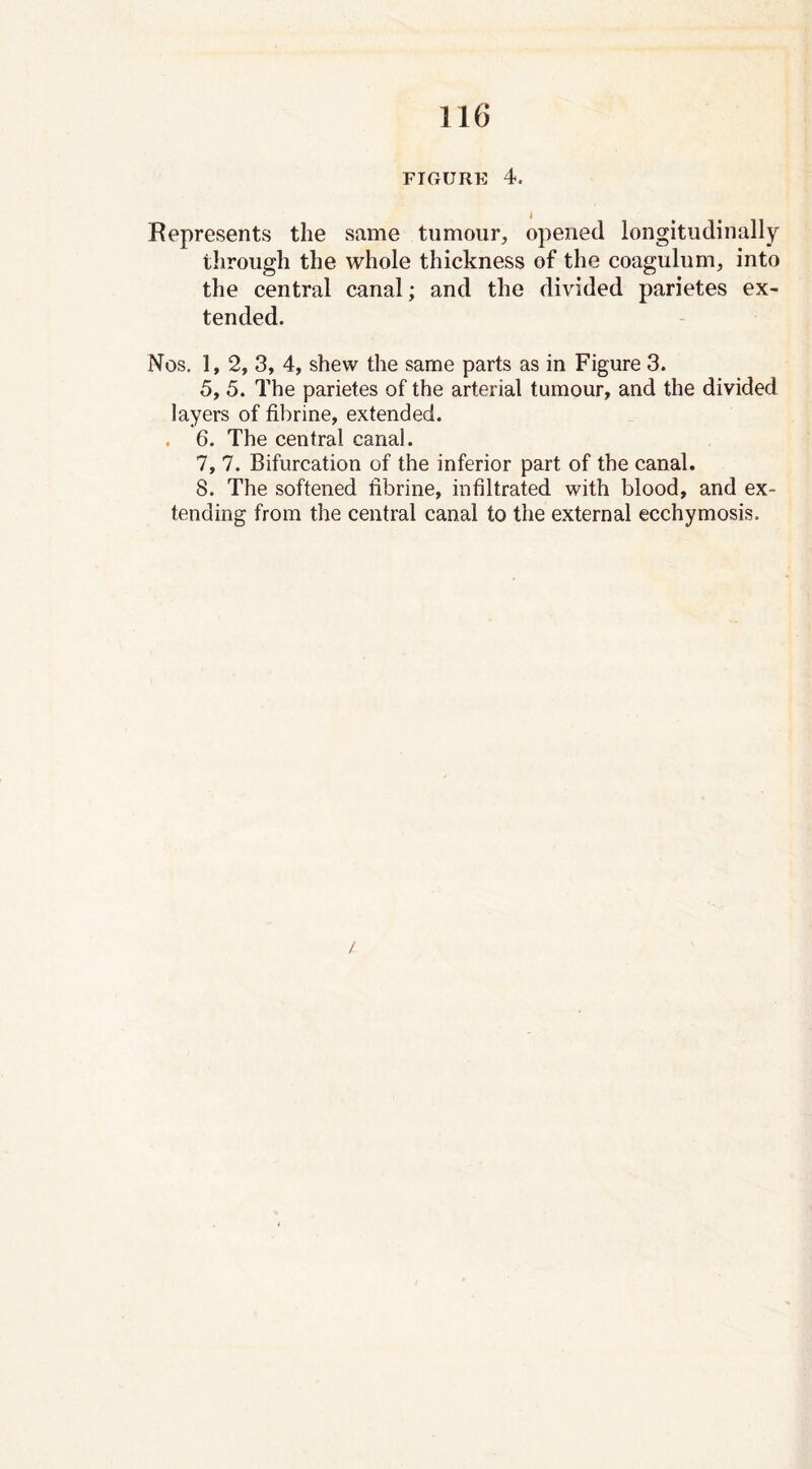 FIGURE 4. Represents the same tumour, opened longitudinally through the whole thickness of the coagulum, into the central canal; and the divided parietes ex- tended. Nos. 1, 2, 3, 4, shew the same parts as in Figure 3. 5, 5. The parietes of the arterial tumour, and the divided layers of fibrine, extended. . 6. The central canal. 7, 7. Bifurcation of the inferior part of the canal. 8. The softened fibrine, infiltrated with blood, and ex- tending from the central canal to the external ecchymosis.
