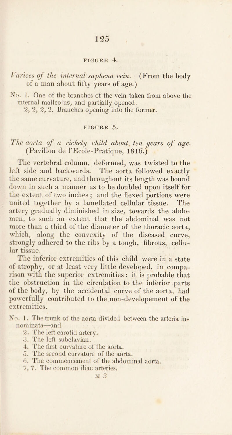 FIGURE 4-. I a rices of the internal saphena vein. (From tlie body of a man about fifty years of age.) No. 1. One of the branches of the vein taken from above the internal malleolus, and partially opened. 2, 2, 2, 2. Branches opening into the former. figure 5. The aorta of a rickety child about ten years of age. (Pavilion de l’Ecole-Pratique, 1816.) The vertebral column, deformed, was twisted to the left side and backwards. The aorta followed exactly the same curvature, and throughout its length was bound down in such a manner as to be doubled upon itself for the extent of two inches; and the flexed portions were united together by a lamellated cellular tissue. The artery gradually diminished in size, towards the abdo- men, to such an extent that the abdominal was not more than a third of the diameter of the thoracic aorta, which, along the convexity of the diseased curve, strongly adhered to the ribs by a tough, fibrous, cellu- lar tissue. The inferior extremities of this child were in a state of atrophy, or at least very little developed, in compa- rison with the superior extremities : it is probable that the obstruction in the circulation to the inferior parts of the body, by the accidental curve of the aorta, had powerfully contributed to the non-developement of the extremities. No. 1. The trunk of the aorta divided between the arteria in- nominata—and 2. The left carotid artery. 3. The left subclavian. 4. The first curvature of the aorta. 5. The second curvature of the aorta. 6. The commencement of the abdominal aorta. 7. 7. The common iliac arteries.
