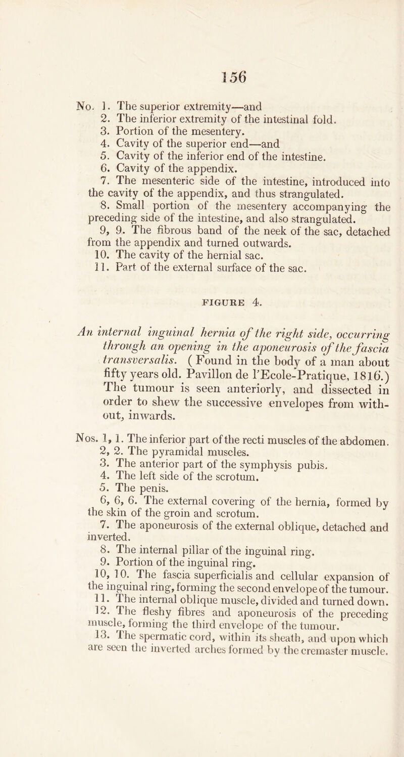 No. 1. The superior extremity—and 2. The inferior extremity of the intestinal fold. 3. Portion of the mesentery. 4. Cavity of the superior end—and 5. Cavity of the inferior end of the intestine. 6. Cavity of the appendix. 7. The mesenteric side of the intestine, introduced into the cavity of the appendix, and thus strangulated. 8. Small portion of the mesentery accompanying the preceding side of the intestine, and also strangulated. 9. 9. The fibrous band of the neek of the sac, detached from the appendix and turned outwards. 10. The cavity of the hernial sac. 11. Part of the external surface of the sac. figure 4. An internal inguinal hernia of the right side, occurring through an opening in the aponeurosis of the fascia transfer satis. ( Found in the body of a man about fifty year sold. Pavilion de PEcole- Pratique, 1816.) The tumour is seen anteriorly, and dissected in order to shew the successive envelopes from with- out, inwards. Nos. 1,1. The inferior part of the recti muscles of the abdomen. 2. 2. The pyramidal muscles. 3. The anterior part of the symphysis pubis. 4. The left side of the scrotum. 5. The penis. 6. 6, 6. The external covering of the hernia, formed by the skin of the groin and scrotum. 7. The aponeurosis of the external oblique, detached and inverted. 8. The internal pillar of the inguinal ring. 9. Portion of the inguinal ring. 10. 10. The fascia superficial is and cellular expansion of the inguinal ring, forming the second envelope of the tumour. 11. The internal oblique muscle, divided and turned down. 12. The fleshy fibres and aponeurosis of the preceding muscle, forming the third envelope of the tumour. 13. Ihe spermatic cord, within its sheath, and upon which aie seen the inverted arches formed by the cremaster muscle.