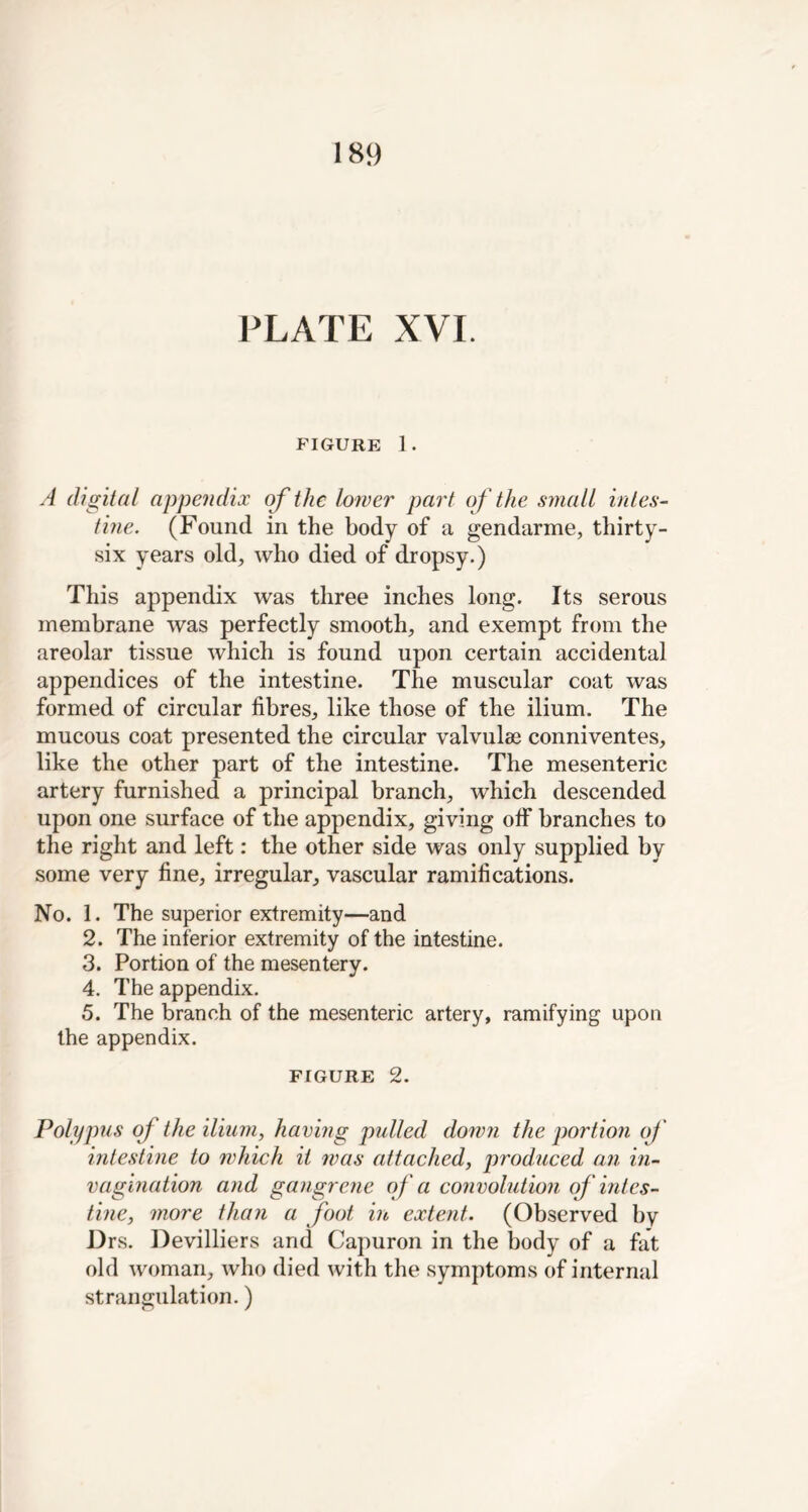 PLATE XVI. FIGURE 1 . A digital appendix of the lower part of the small intes- tine. (Found in the body of a gendarme, thirty- six years old, who died of dropsy.) This appendix was three inches long. Its serous membrane was perfectly smooth, and exempt from the areolar tissue which is found upon certain accidental appendices of the intestine. The muscular coat was formed of circular fibres, like those of the ilium. The mucous coat presented the circular valvulee conniventes, like the other part of the intestine. The mesenteric artery furnished a principal branch, which descended upon one surface of the appendix, giving off branches to the right and left: the other side was only supplied by some very fine, irregular, vascular ramifications. No. 1. The superior extremity—and 2. The inferior extremity of the intestine. 3. Portion of the mesentery. 4. The appendix. 5. The branch of the mesenteric artery, ramifying upon the appendix. FIGURE 2. Polypus of the ilium, having pulled down the portion of intestine to which it was attached, produced an in- vagination and gangrene of a convolution of intes- tine, more than a foot in extent. (Observed by Drs. Devilliers and Capuron in the body of a fat old woman, who died with the symptoms of internal strangulation.)