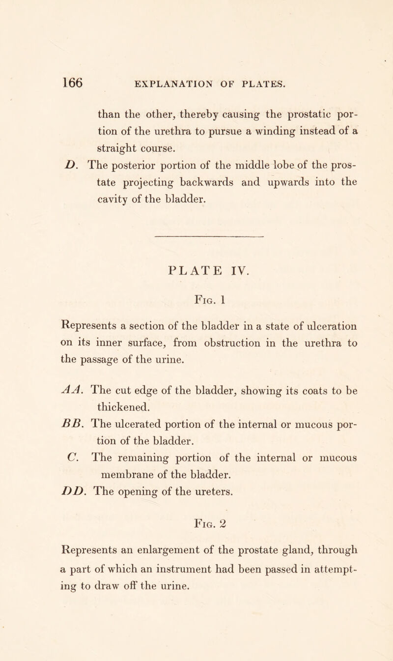 than the other, thereby causing the prostatic por- tion of the urethra to pursue a winding instead of a straight course. D. The posterior portion of the middle lobe of the pros- tate projecting backwards and upwards into the cavity of the bladder. PLATE IV. Fig. 1 Represents a section of the bladder in a state of ulceration on its inner surface, from obstruction in the urethra to the passage of the urine. A A. The cut edge of the bladder, showing its coats to be thickened. BB. The ulcerated portion of the internal or mucous por- tion of the bladder. C. The remaining portion of the internal or mucous membrane of the bladder. DD. The opening of the ureters. Fig. 2 Represents an enlargement of the prostate gland, through a part of which an instrument had been passed in attempt- ing to draw off the urine.