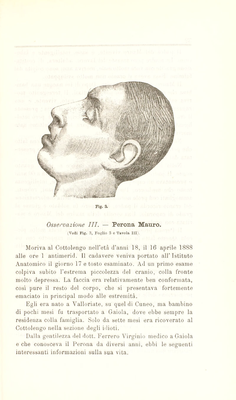 Fig. 3. Osservazione III. — Perona Mauro. (Vedi Fig. 3, Foglio 3 e Tavola III). Moriva al Cottolengo nell’età d’anni 18, il 16 aprile 1888 alle ore 1 antiinerid. Il cadavere veniva portato all’Istituto Anatomico il giorno 17 e tosto esaminato. Ad un primo esame colpiva subito l’estrema piccolezza del cranio, colla fronte molto depressa. La faccia era relativamente ben conformata, cos'i pure il resto del corpo, che si presentava fortemente emaciato in principal modo alle estremità. Egli era nato a Valloriate, su quel di Cuneo, ma bambino di pochi mesi fu trasportato a Gaiola, dove ebbe sempre la residenza colla famiglia. Solo da sette mesi era ricoverato al Cottolengo nella sezione degli idioti. Dalla gentilezza del dolt. Ferrerò Virginio medico a Gaiola e che conosceva il Perona da diversi anni, ebbi le seguenti interessanti informazioni sulla sua vita.