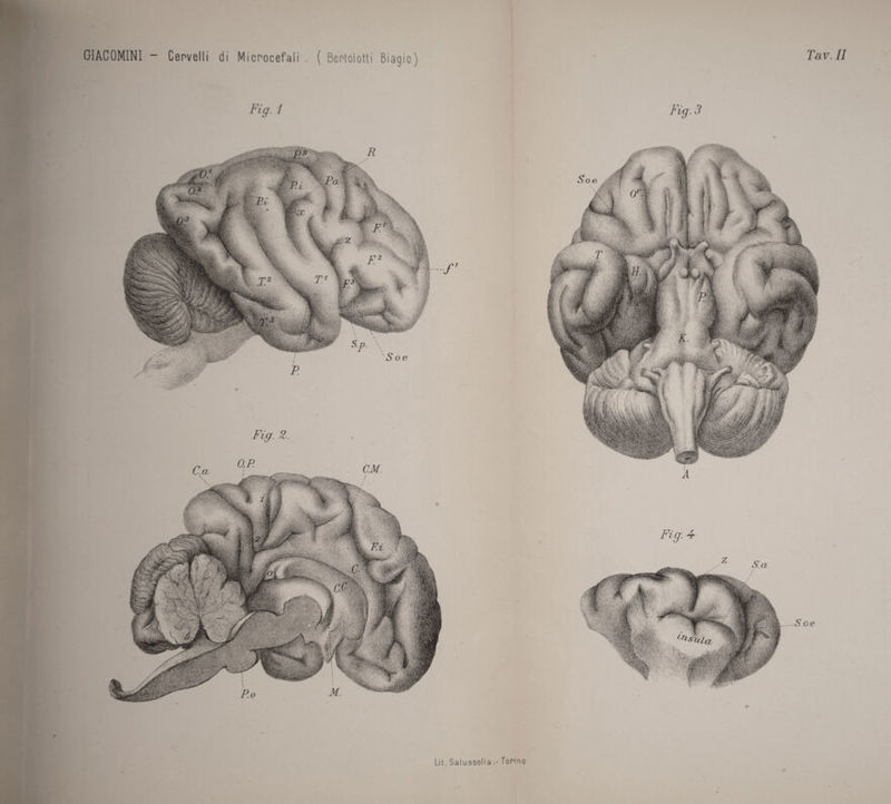 Fig. 1 Fig. 4^ Fvg. 3 S.a ...So e