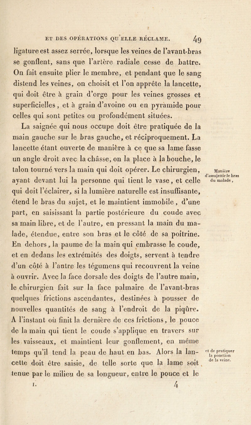 ( Manière d’assujettir le bras du malade, ET DES OPÉRATIONS Qu’eLLE RECLAME. 49 ligature est assez serrée, lorsque les veines de Tavant-bras se gonflent, sans que Tarière radiale cesse de battre. On fait ensuite plier le membre, et pendant que le sang distend les veines, on choisit et Ton apprête la lancette, qui doit être à grain d’orge pour les veines grosses et superficielles, et à grain d’avoine ou en pyramide pour celles qui sont petites ou profondément situées. La saignée qui nous occupe doit être pratiquée de la main gauche sur le bras gauche, et réciproquement. La lancette étant ouverte de manière à ce que sa lame fasse un angle droit avec la châsse, on la place à la bouche, le talon tourné vers la main qui doit opérer. Le chirurgien, ayant devant lui la personne qui tient le vase, et celle qui doit Téclairer, si la lumière naturelle est insuffisante, étend le bras du sujet, et le maintient immobile, d’une part, en saisissant la partie postérieure du coude avec sa main libre, et de Tautre, en pressant la main du ma- lade, étendue, entre son bras et le côté de sa poitrine. En dehors, la paume de la main qui embrasse le coude, et en dedans les extrémités des doigts, servent à tendre d’un côté à Tautre les tégumens qui recouvrent la veine à ouvrir. Avec la face dorsale des doigts de Tautre main, le chirurgien fait sur la face palmaire de Tavant-bras quelques frictions ascendantes, destinées à pousser de nouvelles quantités de sang à Tendroit de la piqûre. A Tinstant où finit la dernière de ces frictions, le pouce de la main qui tient le coude s’applique en travers sur les vaisseaux, et maintient leur gonflement, en même temps qu’il tend la peau de haut en bas. Alors la lan- cette doit être saisie, de telle sorte que la lame soit, tenue par le milieu de sa longueur, entre le pouce et le