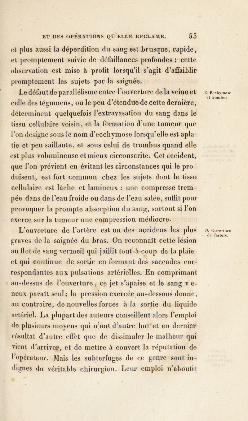 et plus aussi la déperdition du sang est brusque, rapide, et promptement suivie de défaillances profondes : cette observation est mise à profit lorsqu’il s’agit d’alFaiblir promptement les sujets par la saignée. Le défaut de parallélisme entre l’ouverture de la veine et celle des tégumens, ou le peu d’étendue de cette dernière, déterminent quelquefois l’extravasation du sang dans le tissu cellulaire voisin, et la formation d’une tumeur que l’on désigne sous le nom d’ecchymose lorsqu’elle est apla- tie et peu saillante, et sous celui de trombus quand elle est plus volumineuse et mieux circonscrite. Cet accident, que l’on prévient en évitant les circonstances qui le pro- duisent, est fort commun chez les sujets dont le tissu cellulaire est lâche et lamineux : une compresse trem- pée dans de l’eau froide ou dans de l’eau salée, suffit pour provoquer la prompte absorption du sang, surtout si l’on exerce sur la tumeur une compression médiocre. L’ouverture de l’artère est un des accidens les plus graves de la saignée du bras. On reconnaît cette lésion au flot de sang vermeil qui jaillit tout-à-coup de la plaie et qui continue de sor^r en formant des saccades cor- respondantes au X puisa lions artérielles. En comprimant au-dessus de l’ouverture, ce jet s’apaise et le sang v e- neux paraît seul; la pression exercée au-dessous donne, au contraire, de nouvelles forces à la sortie du liquide artériel. La plupart des auteurs conseillent alors l’emploi de plusieurs moyens qui n’ont d’autre but et en dernier résultat d’autre effet que de dissimuler le malheur qui vient d’arriver, et de mettre à couvert la réputation de l’opérateur. Mais les subterfuges de ce genre sont in- dignes du véritable chirurgien. Leur emploi n’aboutit C. Ecchymose et trombus. D, Ouverture de l’artère.