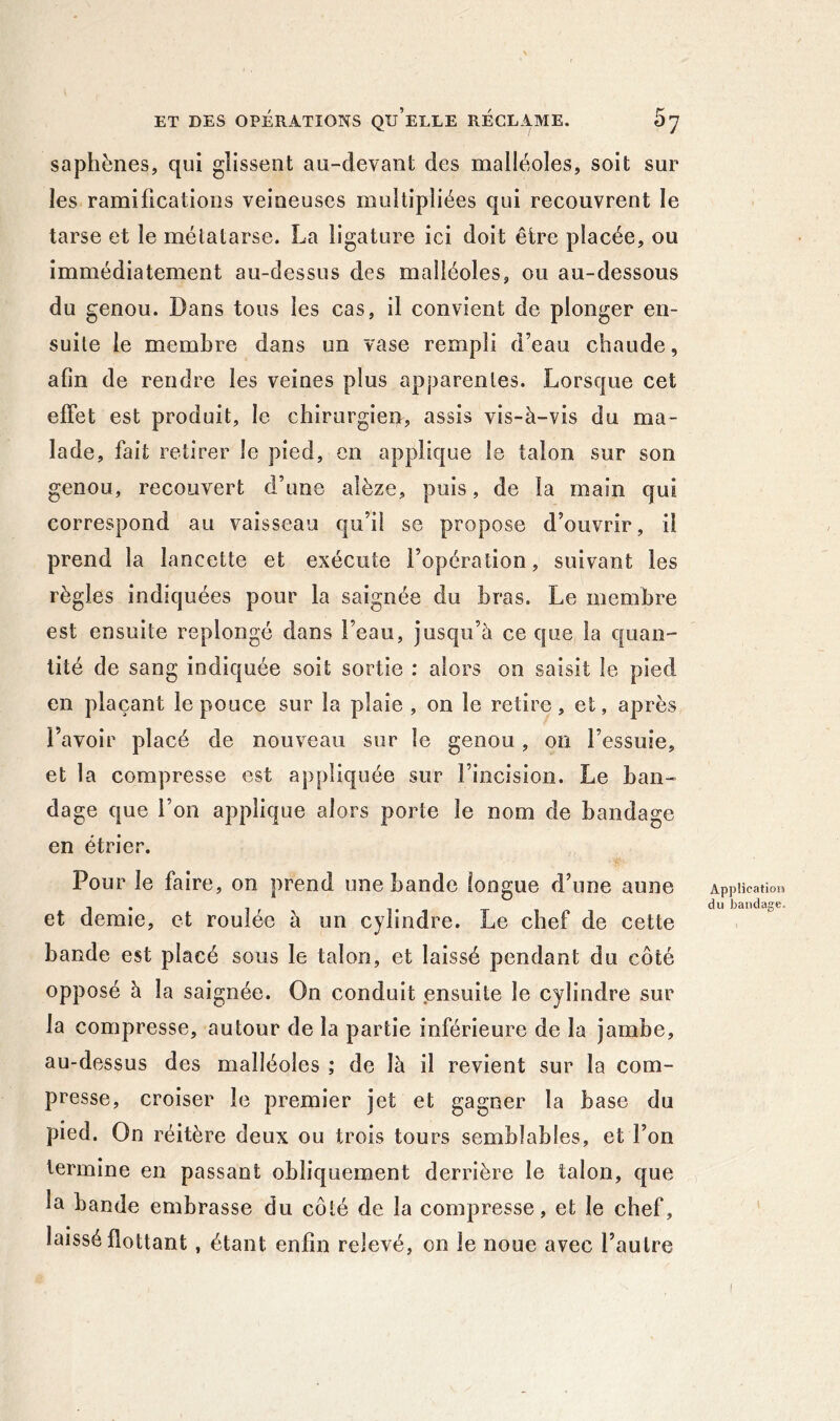 saphènes, qui glissent au-devant des malléoles, soit sur les ramifications veineuses multipliées qui recouvrent le tarse et le mélatarse. La ligature ici doit être placée, ou immédiatement au-dessus des malléoles, ou au-dessous du genou. Dans tous les cas, il convient de plonger en- suite le membre dans un vase rempli d’eau chaude, afin de rendre les veines plus apparentes. Lorsque cet effet est produit, le chirurgien, assis vis-à-vis du ma- lade, fait retirer le pied, en applique le talon sur son genou, recouvert d’une alèze, puis, de la main qui correspond au vaisseau qu’il se propose d’ouvrir, il prend la lancette et exécute l’opération, suivant les règles indiquées pour la saignée du bras. Le membre est ensuite replongé dans l’eau, jusqu’à ce que la quan- tité de sang indiquée soit sortie : alors on saisit le pied en plaçant le pouce sur la plaie , on le retire, et, après l’avoir placé de nouveau sur le genou, on l’essuie, et la compresse est appliquée sur l’incision. Le ban- dage que l’on applique alors porte le nom de bandage en étrier. Pour le faire, on prend une bande longue d’une aune et demie, et roulée à un cylindre. Le chef de cette bande est placé sous le talon, et laissé pendant du côté opposé à la saignée. On conduit ensuite le cylindre sur la compresse, autour de la partie inférieure de la jambe, au-dessus des malléoles ; de là il revient sur la com- presse, croiser le premier jet et gagner la base du pied. On réitère deux ou trois tours semblables, et l’on termine en passant obliquement derrière le talon, que la bande embrasse du côté de la compresse, et le chef, laissé flottant, étant enfin relevé, on le noue avec l’autre ApplicatioH du bandage. I