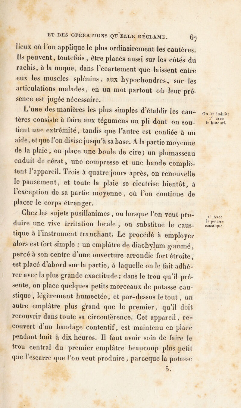 lieux OÙ Ion applique le plus ordinairement les cautères. Ils peuvent, toutefois, être placés aussi sur les côtés du rachis, à la nuque, dans l’écartement que laissent entre eux les muscles splénius, aux hypochondres, sur les articulations malades, en un mot partout où leur pré- sence est jugée nécessaire. L’une des manières les plus simples d’établir les cau- tères consiste à faire aux tégumens un pli dont on sou- tient une extrémité, tandis que l’autre est confiée à un aide, et que 1 on divise j usqu’à sa base. A la partie moyenne de la plaie, on place une boule de cire; un plumasseau enduit de cérat, une compresse et une bande complè- tent 1 appareil. Trois à quatre jours après, on renouvelle le pansement, et toute la plaie se cicatrise bientôt, à l’exception de sa partie moyenne, où l’on continue de placer le corps étranger. Chez les sujets pusillanimes , ou lorsque l’on veut pro- duire une vive irritation locale , on substitue le caus- tique à 1 instrument tranchant. Le procédé à employer alors est fort simple : un emplâtre de diachylum gommé, percé à son centre d’une ouverture arrondie fort étroite, est placé d’abord sur la partie, à laquelle on le fait adhé- rer avec la plus grande exactitude; dans le trou qu’il pré- sente, on place quelques petits morceaux de potasse cau- stique , légèrement humectée, et par-dessus le tout, un autre emplâtre plus gVand que le premier, qu’il doit recouvrir dans toute sa circonférence. Cet appareil, re- couvert d’un bandage contentif, est maintenu en place pendant huit à dix heures. Il faut avoir soin de faire le trou central du premier emplâtre beaucoup plus petit que l’escarre que l’on veut produire, parceque la potasse O e On les élablit i” avec le bistouri, 2® Avec la potasse caustique.