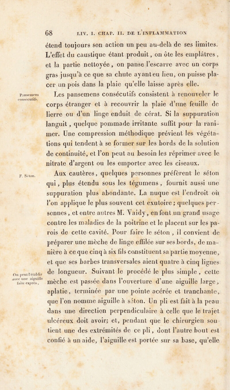 étend toujours son action un peu au-delà de ses limites. L’effet du caustique étant produit, on ôte les emplâtres , et la partie nettoyée, on panse l’escarre avec un corps gras jusqu’à ce que sa chute ayant eu heu, on puisse pla- cer un pois dans la plaie qu’elle laisse après elle. pansemcns Les pausemeus consécutifs consistent à renouveler le cnnst'cutifs, corps étranger et à recouvrir la plaie d’une feuille de lierre ou d’un linge enduit de cérat. Si la suppuration languit , quelque pommade irritante suffit pour la rani- mer. Une compression méthodique prévient les végéta- tions qui tendent à se former sur les bords de la solution de continuité, et l’on peut au besoin les réprimer avec le nitrate d’argent ou les emporter avec les ciseaux. F s.ton. cautères, quelques personnes préfèrent le séton qui, plus étendu sous les tégumens , fournit aussi une suppuration plus abondante. La nuque est l’endroit où î’on applique le plus souvent cet exutoire ; quelques per- sonnes , et entre autres M’. Yaidy, en font un grand usage contre les maladies de la poitrine et le placent sur les pa- rois de cette cavité. Pour faire le séton , il convient de préparer une mèche de linge effilée sur ses bords, de ma- nière à ce que cinq à six fils canstituent sa partie moyenne, et que ses barbes transversales aient quatre à cinq lignes On peut rétablir longLieur. Suivant le procédé le plus simple, cette '’Yaitc’extS!'*'' mèche est passée dans l’ouverture d’une aiguille large^ aplatie, terminée par une pointe acérée et tranchante, que l’on nomme aiguille à sôton. Un pli est fait à la peau dans une direction perpendiculaire à celle que le trajet ulcéreux doit avoir; et, pendant que le chirurgien sou tient une des extrémités de ce pli, dont l’autre bout est confié à un aide, l’aiguille est portée sur sa base, qu’elle