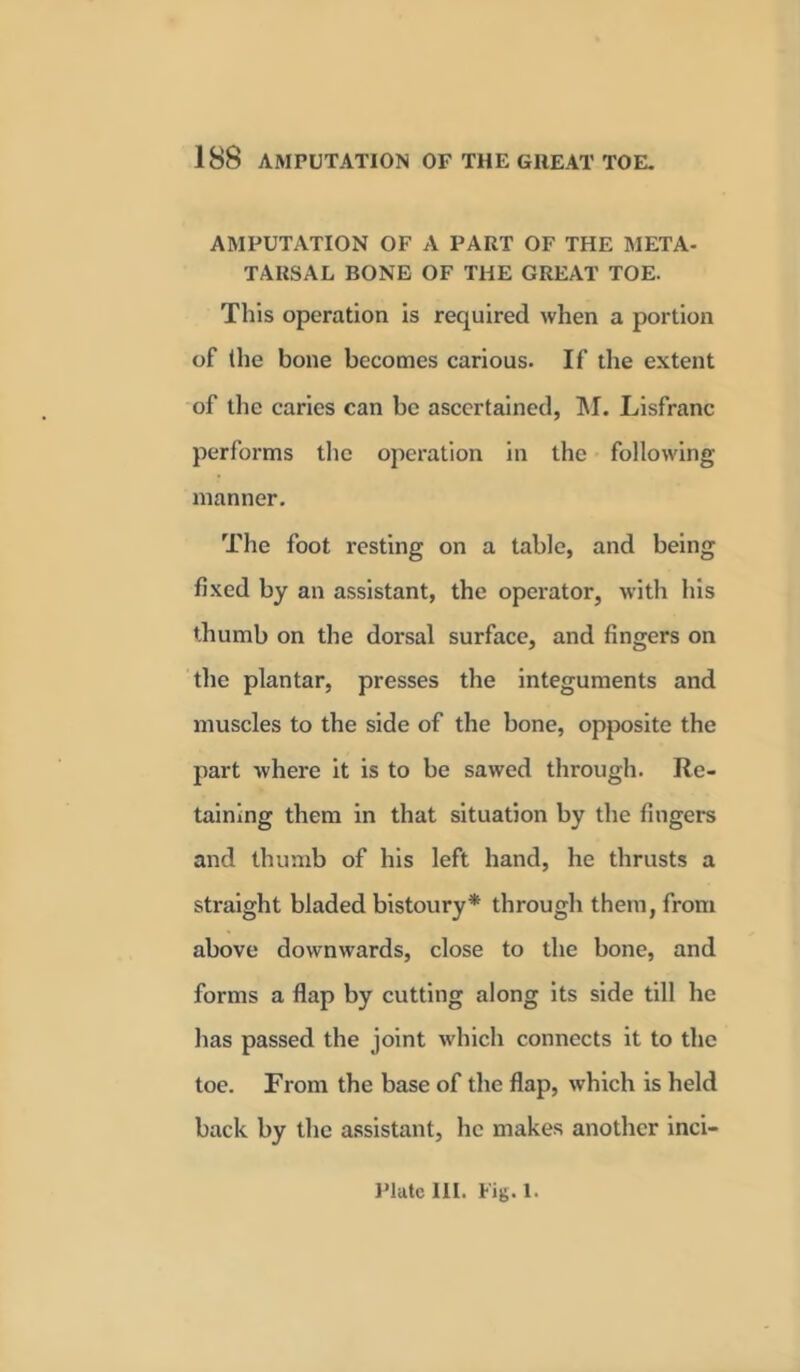 AMPUTATION OF A PART OF THE META- TARSAL BONE OF THE GREAT TOE. This operation is required when a portion of the bone becomes carious. If the extent of the caries can be ascertained, M. Lisfranc performs the operation in the following manner. The foot resting on a table, and being fixed by an assistant, the operator, with his thumb on the dorsal surface, and fingers on the plantar, presses the integuments and muscles to the side of the bone, opposite the part where it is to be sawed through. Re- taining them in that situation by the fingers and thumb of his left hand, he thrusts a straight bladed bistoury* through them, from above downwards, close to the bone, and forms a flap by cutting along its side till he has passed the joint which connects it to the toe. From the base of the flap, which is held back by the assistant, he makes another inci- Platelll. Fig. 1.