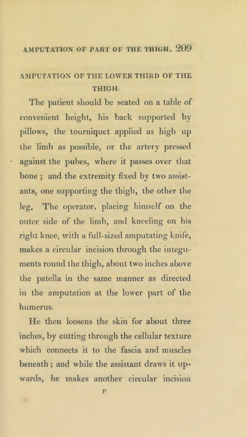 AMPUTATION OF THE LOWER THIRD OF THE THIGH- The patient should be seated on a table of convenient height, his back supported by pillows, the tourniquet applied as high up the limb as possible, or the artery pressed - against the pubes, where it passes over that bone ; and the extremity fixed by two assist- ants, one supporting the thigh, the other the leg. The operator, placing himself on the outer side of the limb, and kneeling on his right knee, with a full-sized amputating knife, makes a circular incision through the integu- ments round the thigh, about two inches above the patella in the same manner as directed in the amputation at the lower part of the humerus. He then loosens the skin for about three inches, by cutting through the cellular texture which connects it to the fascia and muscles beneath; and while the assistant draws it up- wards, he makes another circular incision p