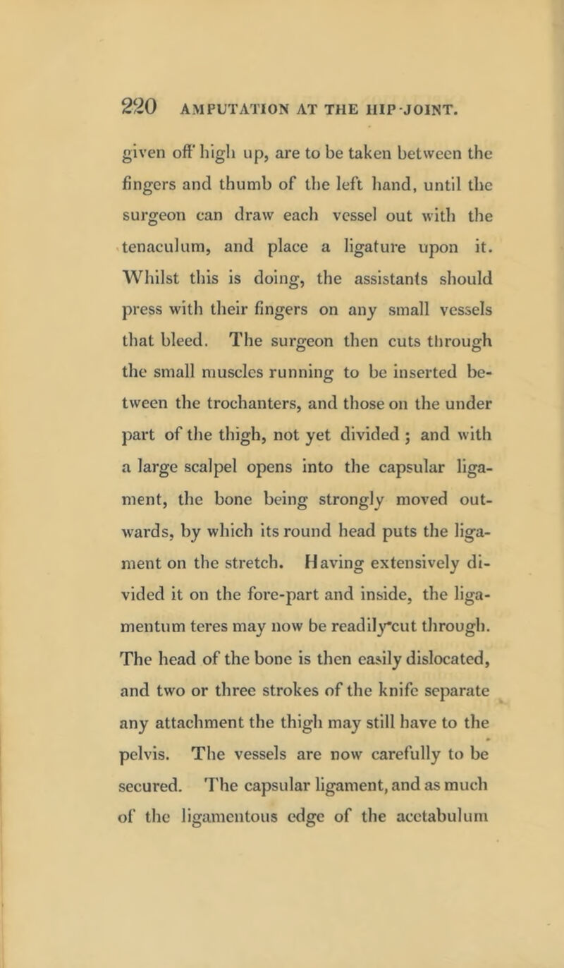 given oft' high up, are to be taken between the fingers and thumb of the left hand, until the surgeon can draw each vessel out with the tenaculum, and place a ligature upon it. Whilst this is doing, the assistanfs should press with their fingers on any small vessels that bleed. The surgeon then cuts through the small muscles running to be inserted be- tween the trochanters, and those on the under part of the thigh, not yet divided ; and with a large scalpel opens into the capsular liga- ment, the bone being strongly moved out- wards, by which its round head puts the liga- ment on the stretch. Having extensively di- vided it on the fore-part and inside, the liga- mentum teres may now be readilycut through. The head of the bone is then easily dislocated, and two or three strokes of the knife separate any attachment the thigh may still have to the pelvis. The vessels are now carefully to be secured. The capsular ligament, and as much of the ligamentous edge of the acetabulum