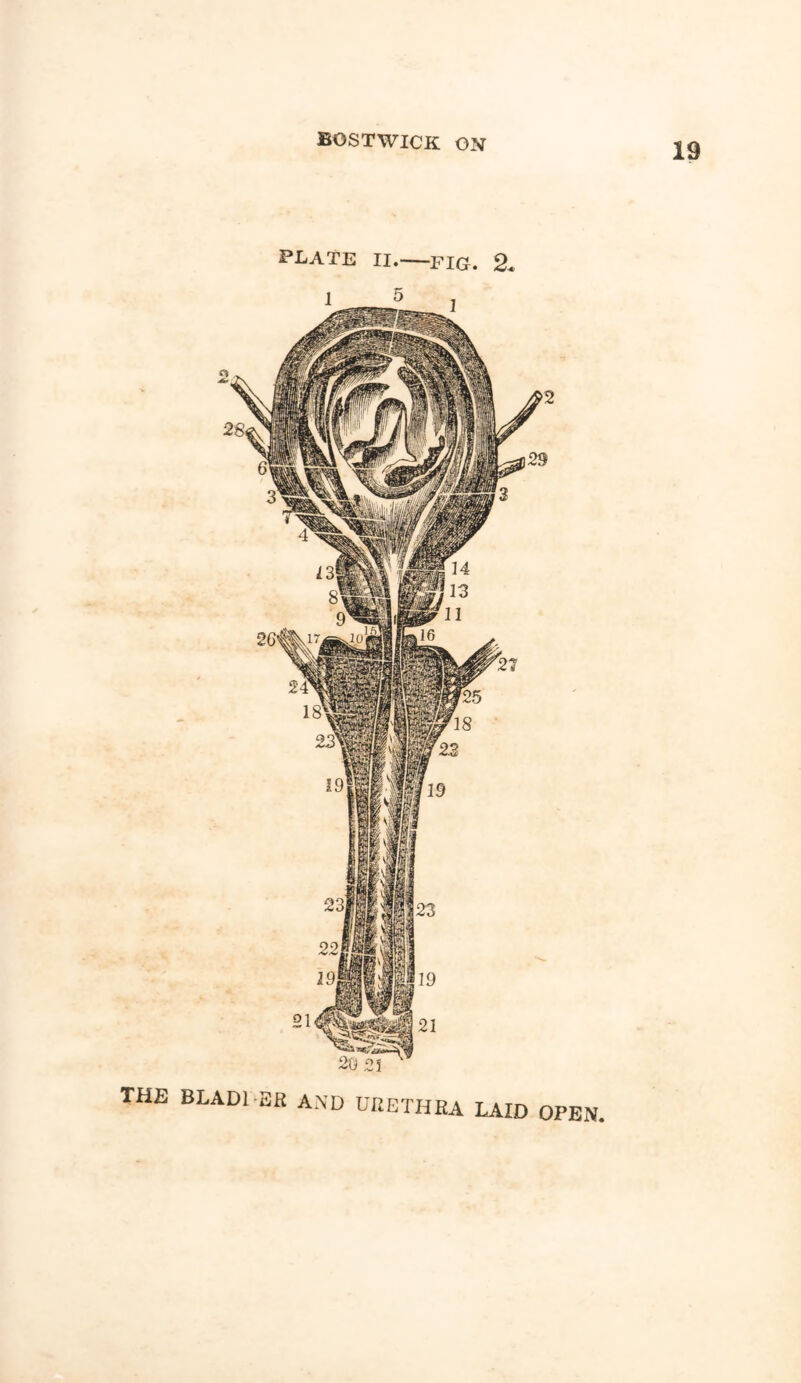 PLATE II. fig. 2. 1 5 the BLADl-SR AND URETHRA LAID OPEN.
