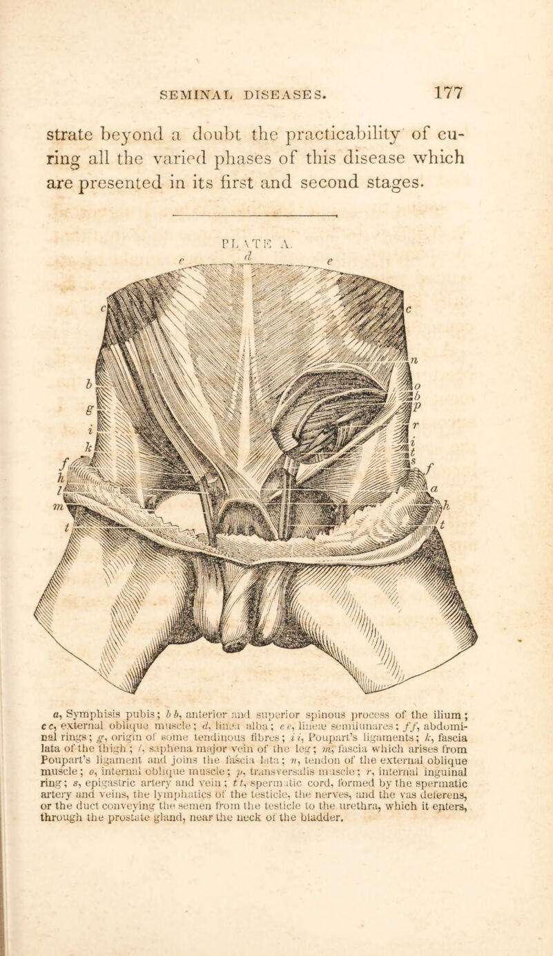 strate beyond a donbt the practicability of cu- ring all the varied phases of this disease which are presented in its first and second stages. PL\TE A. a, Symphisis pubis; b b, ariterio!- rui'l su])crior spinous ])rocess of the ilium; cc, external oblicpie muscle; d. liiua alba; ec, line;e senuiunares; //, abdomi- cal rings; g-, origin of some tendinous fibres; O', Pouparl’s ligaments; /,, fascia lata of the thigh ; /, saphena major vein of the leg; fascia which arises from Poupart’s ligament and joins the fascia lata; », tendon of the external oblique muscle; o, internal oblKiue muscle; p, transversaiis muscle; r, internal inguinal ring; s, epigastric artery and vein ; tb sperm.itic cord, formed by the spermatic artery and veins, the lymjjhatics of the testicle, t!ie nerves, :uid the vas deferens, or the duct conveying the semen from the testicle to the urethra, which it ejiters, through the prostate gliuid, near the neck ot the bladder.