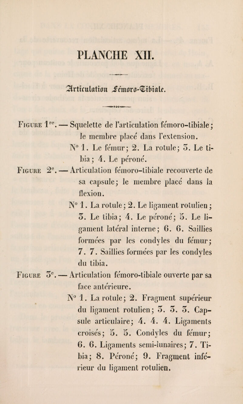 PLANCHE XII. 2lrttculatt0n Jfmora-^tbtale. Figure lre.— Squelette de l’articulation fémoro-tibiale ; le membre place' dans Fextension. N° 1. Le fémur; 2. La rotule; 3. Le ti¬ bia; 4. Le péroné. Figure 2e. — Articulalion fémoro-tibiale recouverte de sa capsule; le membre placé dans la flexion. N° 1. La rotule; 2. Le ligament rolulien ; 3. Le tibia; 4. Le péroné; 5. Le li¬ gament latéral interne; 6. 6. Saillies formées par les condyles du fémur; 7. 7. Saillies formées par les condyles du tibia. Figure 3e. — Articulation fémoro-tibiale ouverte par sa face antérieure. N° 1. La rotule; 2. Fragment supérieur du ligament rotulien; 3. 3. 3. Cap¬ sule articulaire; 4. 4. 4. Ligaments croisés; 5. 5. Condyles du fémur; 6. 6. Ligaments semi-lunaires; 7. Ti¬ bia; 8. Péroné; 9. Fragment infé¬ rieur du ligament rotulien.