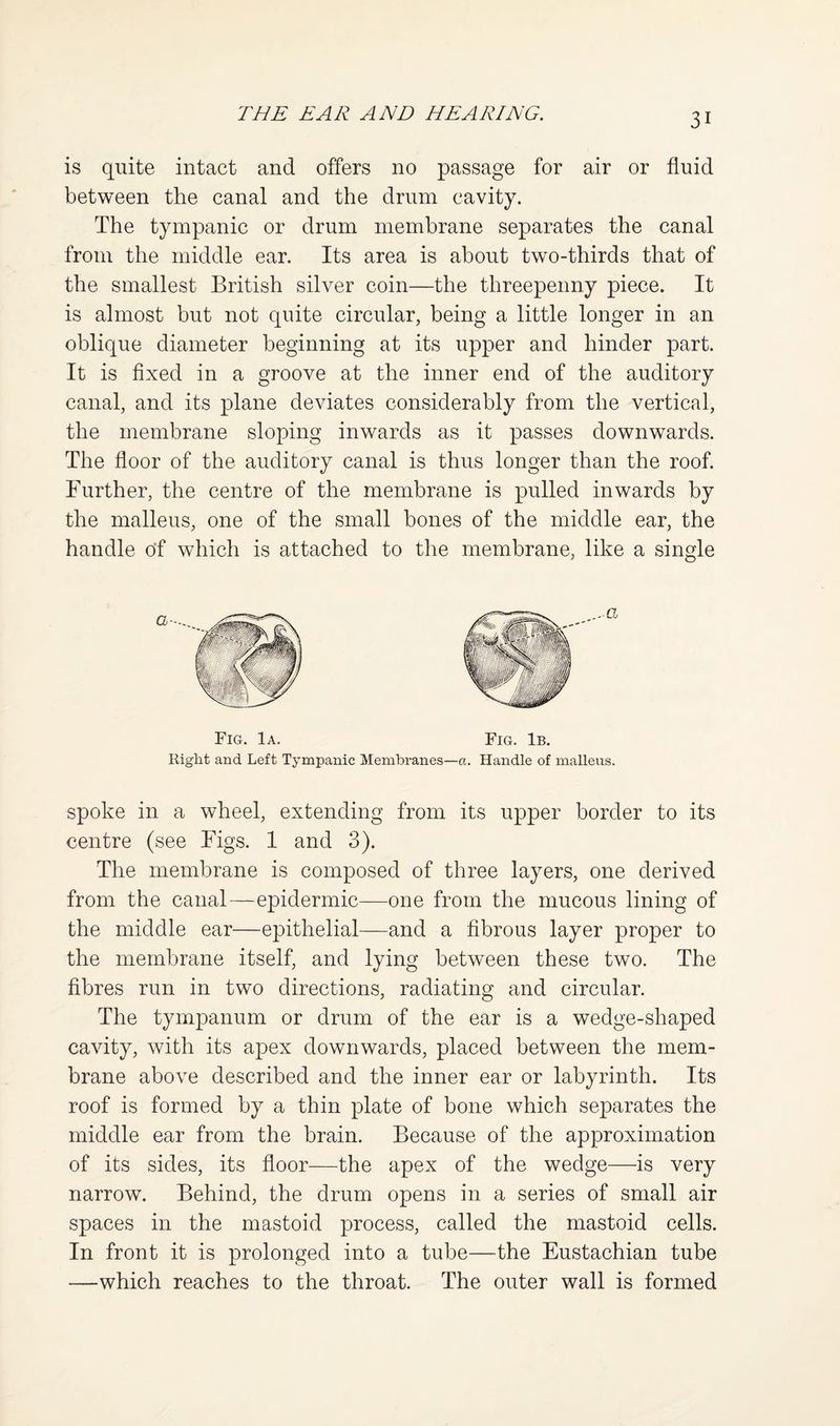 is quite intact and offers no passage for air or fluid between the canal and the drum cavity. The tympanic or drum membrane separates the canal from the middle ear. Its area is about two-thirds that of the smallest British silver coin—the threepenny piece. It is almost but not quite circular, being a little longer in an oblique diameter beginning at its upper and hinder part. It is fixed in a groove at the inner end of the auditory canal, and its plane deviates considerably from the vertical, the membrane sloping inwards as it passes downwards. The floor of the auditory canal is thus longer than the roof. Further, the centre of the membrane is pulled inwards by the malleus, one of the small bones of the middle ear, the handle of which is attached to the membrane, like a single Fig. 1a. Fig. 1b. Right and Left Tympanic Membranes—a. Handle of malleus. spoke in a wheel, extending from its upper border to its centre (see Figs. 1 and 3). The membrane is composed of three layers, one derived from the canal—epidermic—one from the mucous lining of the middle ear—epithelial—and a fibrous layer proper to the membrane itself, and lying between these two. The fibres run in two directions, radiating and circular. The tympanum or drum of the ear is a wedge-shaped cavity, with its apex downwards, placed between the mem¬ brane above described and the inner ear or labyrinth. Its roof is formed by a thin plate of bone which separates the middle ear from the brain. Because of the approximation of its sides, its floor—the apex of the wedge—is very narrow. Behind, the drum opens in a series of small air spaces in the mastoid process, called the mastoid cells. In front it is prolonged into a tube—the Eustachian tube —which reaches to the throat. The outer wall is formed