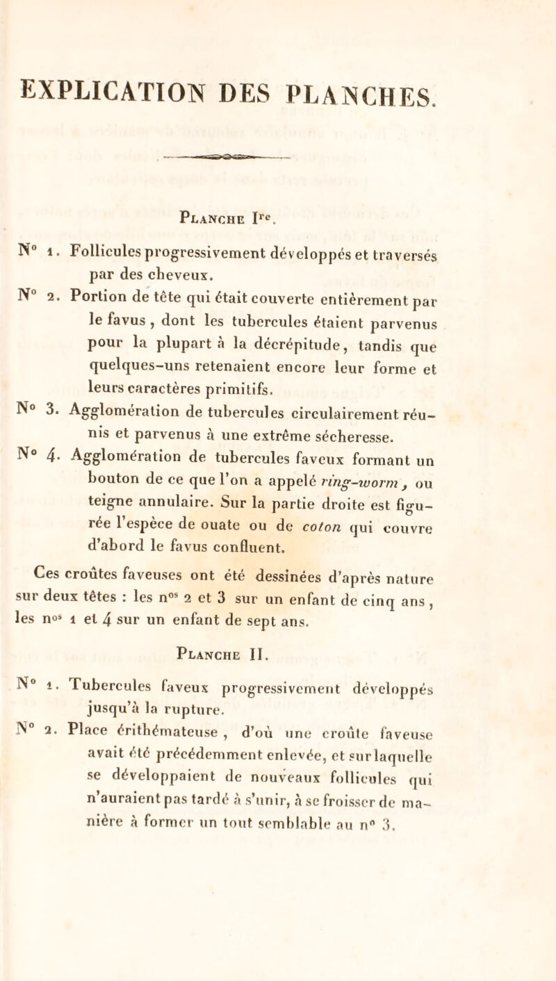 EXPLICATION DES PLANCHES. Planche Irc. N° 1. Follicules progressivement développés et traversés par des cheveux. N° 2. Portion de tête qui était couverte entièrement par le favus , dont les tubercules étaient parvenus pour la plupart à la décrépitude, tandis que quelques-uns retenaient encore leur forme et leurs caractères primitifs. N° 3. Agglomération de tubercules circulairement réu¬ nis et parvenus a une extrême sécheresse. N° 4. Agglomération de tubercules faveux formant un bouton de ee que l’on a appelé ring-worm , ou teigne annulaire. Sur la partie droite est figu¬ rée 1 espece de ouate ou de coton qui couvre d’abord le favus confluent. Ces croûtes faveuses ont été dessinées d’après nature sur deux tetes : les n0i 2 et 3 sur un enfant de cinq ans, les n°s î et 4 sur un enfant de sept ans. Planche II. vV° î. Tubercules faveux progressivement développés jusqu’à la rupture. N 2. Place érithémateuse , d’où une croûte faveuse avait été précédemment enlevée, et sur laquelle se développaient de nouveaux follicules qui n auraient pas tardé a s’unir, à se froisser de ma¬ nière à former un tout semblable au n° 3.