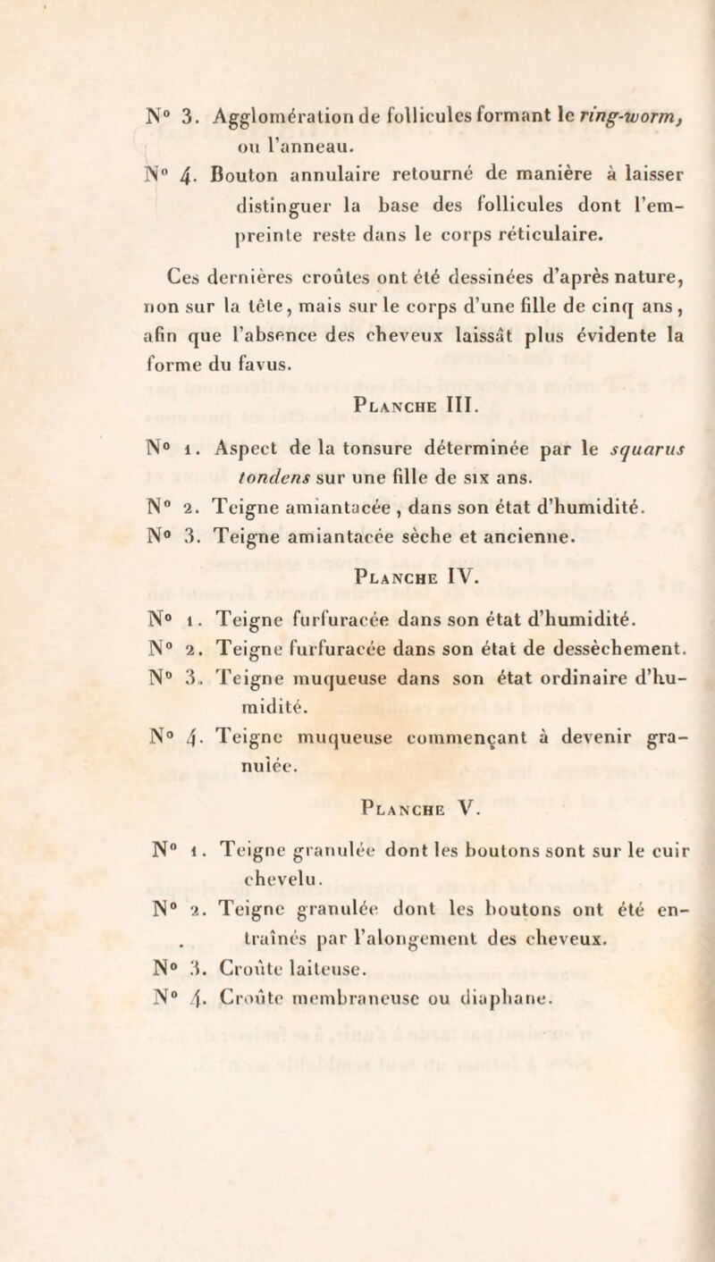 N° 3. Agglomération de follicules formant le ring-worm, ou l’anneau. IN 4- Bouton annulaire retourné de manière à laisser distinguer la base des follicules dont l’em¬ preinte reste dans le corps réticulaire. Ces dernières croûtes ont été dessinées d’après nature, non sur la tête, mais sur le corps d’une fille de cinq ans , afin que l’absence des cheveux laissât plus évidente la forme du favus. Planche III. N° i. Aspect de la tonsure déterminée par le squarus fondent sur une fille de six ans. N° 2. Teigne amiantacée , dans son état d’humidité. N° 3. Teigne amiantacée sèche et ancienne. Planche IV. N° i. Teigne furfuracée dans son état d’humidité. N° 2. Teigne furfuracée dans son état de dessèchement. N° 3. Teigne muqueuse dans son état ordinaire d’hu¬ midité. N° 4- Teigne muqueuse commençant à devenir gra¬ nulée. Planche V. N° 1. Teigne granulée dont les boutons sont sur le cuir chevelu. N° 2. Teigne granulée dont les boutons ont été en- . traînés par l’alongement des cheveux. N° 3. Croûte laiteuse. N° 4* Croûte membraneuse ou diaphane.
