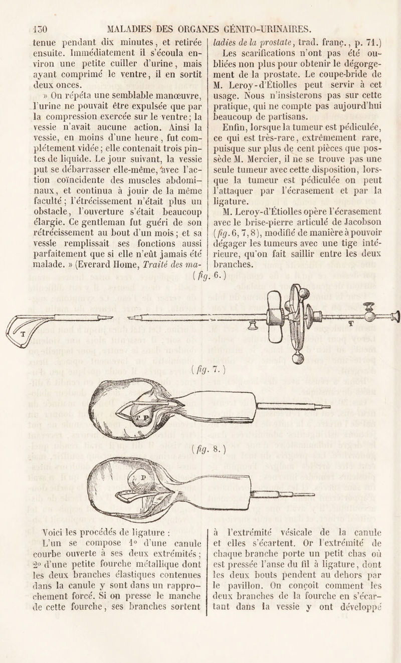 tenue pendant dix minutes, et retirée ensuite. Immédiatement il s’écoula en- viron une petite cuiller d’urine, mais ayant comprimé le ventre, il en sortit deux onces. » On répéta une semblable manœuvre, l’urine ne pouvait être expulsée que par la compression exercée sur le ventre ; la vessie n’avait aucune action. Ainsi la vessie, en moins d’une heure, fut com- plètement vidée ; elle contenait trois pin- tes de liquide. Le jour suivant, la vessie put se débarrasser elle-même,‘‘avec l’ac- tion coïncidente des muscles abdomi- naux, et continua à jouir de la même faculté ; rétrécissement n’était plus un obstacle, l’ouverture s’était beaucoup élargie. Ce gentleman fut guéri de son rétrécissement au bout d’un mois ; et sa vessie remplissait ses fonctions aussi parfaitement que si elle n’eût jamais été malade. » (Everard Home, Traité des ma- {fa ladies de la prostate, trad. franc., p. 71.) Les scarifications n’ont pas été ou- bliées non plus pour obtenir le dégorge- ment de la prostate. Le coupe-bride de M. Leroy-d’Étiolles peut servir à cet usage. Nous n’insisterons pas sur cette pratique, qui ne compte pas aujourd’hui beaucoup de partisans. Enfin, lorsque la tumeur est pédiculée, ce qui est très-rare, extrêmement rare, puisque sur plus de cent pièces que pos- sède M. Mercier, il ne se trouve pas une seule tumeur avec cette disposition, lors- que la tumeur est pédiculée on peut l’attaquer par l’écrasement et par la ligature. M. Leroy-d’Étiolles opère l’écrasement avec le brise-pierre articulé de Jacobson ( fig. 6, 7,8), modifié de manière à pouvoir dégager les tumeurs avec une tige inté- rieure, qu’on fait saillir entre les deux branches. 6.) (fig- M Voici les procédés de ligature : L’un se compose 1° d’une canule courbe ouverte à ses deux extrémités ; 2° d’une petite fourche métallique dont les deux branches élastiques contenues dans la canule y sont dans un rappro- chement forcé. Si on presse le manche de cette fourche, ses branches sortent à l’extrémité vésicale de la canule et elles s’écartent. Or l’extrémité de chaque branche porte un petit chas où est pressée î’anse du fil à ligature, dont les deux bouts pendent au dehors par le pavillon. On conçoit comment les deux branches de la fourche en s’écar- tant dans îa vessie y ont développé