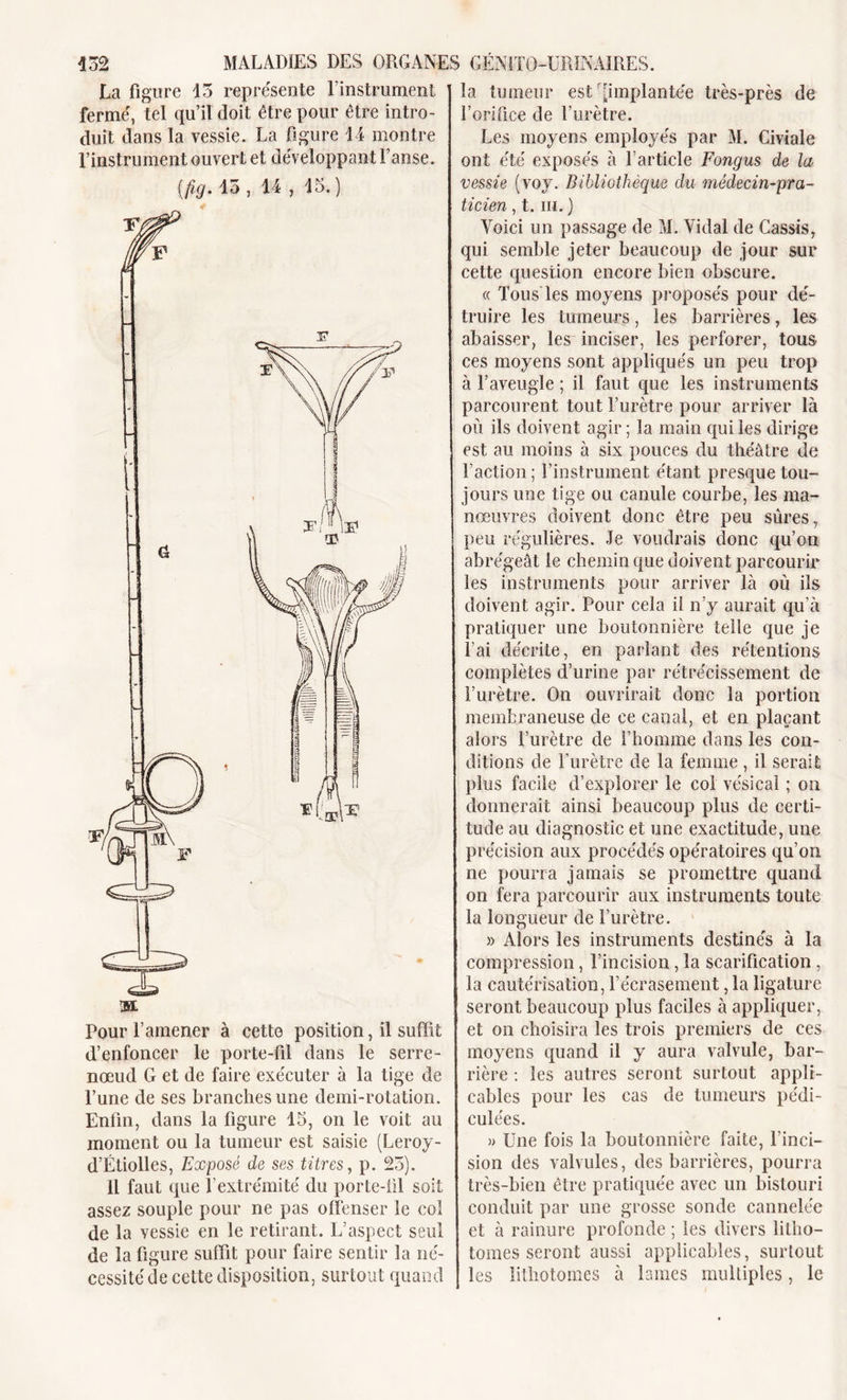 La figure 15 représente l’instrument fermé, tel qu’il doit être pour être intro- duit dans la vessie. La figure 14 montre l’instrument ouvert et développant l’anse. (fig. 15, 14 , 15.) Pour l’amener à cette position, il suffit d’enfoncer le porte-fil dans le serre- nœud G et de faire exécuter à la tige de l’une de ses branches une demi-rotation. Enfin, dans la figure 15, on le voit au moment ou la tumeur est saisie (Leroy - d’Étiolles, Exposé de ses titres, p. 25). Il faut que l’extrémité du porte-fil soit assez souple pour ne pas offenser le col de la vessie en le retirant. L’aspect seul de la figure suffit pour faire sentir la né- cessité de celte disposition, surtout quand la tumeur est'[implantée très-près de l’orifice de l’urètre. Les moyens employés par M. Civiale ont été exposés à l’article Fongus de la vessie (voy. Bibliothèque du médecin-pra- ticien , t. m. ) Voici un passage de M. Vidal de Cassis, qui semble jeter beaucoup de jour sur cette question encore bien obscure. « Tous les moyens proposés pour dé- truire les tumeurs, les barrières, les abaisser, les inciser, les perforer, tous ces moyens sont appliqués un peu trop à l’aveugle ; il faut que les instruments parcourent tout l’urètre pour arriver là ou ils doivent agir; la main qui les dirige est au moins à six pouces du théâtre de l’action; l’instrument étant presque tou- jours une tige ou canule courbe, les ma- nœuvres doivent donc être peu sûres, peu régulières. Je voudrais donc qu’on abrégeât le chemin que doivent parcourir les instruments pour arriver là où ils doivent agir. Pour cela il n’y aurait qu’à pratiquer une boutonnière telle que je l’ai décrite, en parlant des rétentions complètes d’urine par rétrécissement de l’urètre. On ouvrirait donc la portion membraneuse de ce canal, et en plaçant alors l’urètre de l’homme dans les con- ditions de l’urètre de la femme , il serait plus facile d’explorer le col vésical ; on donnerait ainsi beaucoup plus de certi- tude au diagnostic et une exactitude, une précision aux procédés opératoires qu’on ne pourra jamais se promettre quand on fera parcourir aux instruments toute la longueur de l’urètre. » Alors les instruments destinés à la compression, l’incision, la scarification , la cautérisation, l’écrasement, la ligature seront beaucoup plus faciles à appliquer, et on choisira les trois premiers de ces moyens quand il y aura valvule, bar- rière : les autres seront surtout appli- cables pour les cas de tumeurs pédi- culées. » Une fois la boutonnière faite, l’inci- sion des valvules, des barrières, pourra très-bien être pratiquée avec un bistouri conduit par une grosse sonde cannelée et à rainure profonde ; les divers litho- tomes seront aussi applicables, surtout les litliotomes à lames multiples, le