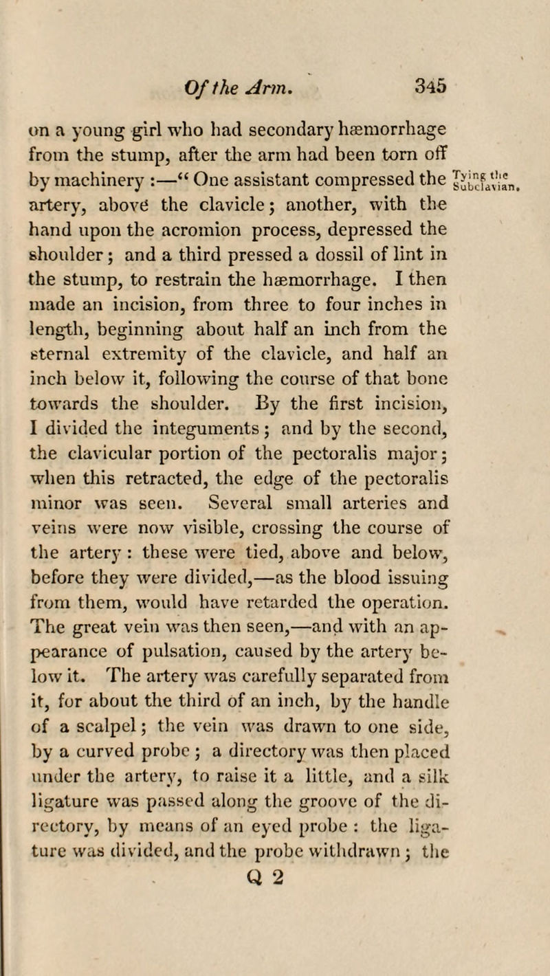 on a young girl who had secondary haemorrhage from the stump, after the arm had been torn off by machinery :—“ One assistant compressed the artery, above the clavicle; another, with the hand upon the acromion process, depressed the shoulder; and a third pressed a dossil of lint in the stump, to restrain the haemorrhage. I then made an incision, from three to four inches in length, beginning about half an inch from the sternal extremity of the clavicle, and half an inch below it, following the course of that bone towards the shoulder. By the first incision, I divided the integuments; and by the second, the clavicular portion of the pectoralis major; when this retracted, the edge of the pectoralis minor was seen. Several small arteries and veins were now visible, crossing the course of the artery : these were tied, above and below, before they were divided,—as the blood issuing from them, wovdd have retarded the operation. The great vein was then seen,—and with an ap¬ pearance of pulsation, caused by the artery be¬ low it. The artery was carefully separated from it, for about the third of an inch, by the handle of a scalpel; the vein was drawn to one side, by a curved probe ; a directory was then placed under the artery, to raise it a little, and a silk ligature was passed along the groove of the di¬ rectory, by means of an eyed probe : the liga¬ ture was divided, and the probe withdrawn; the Q 2