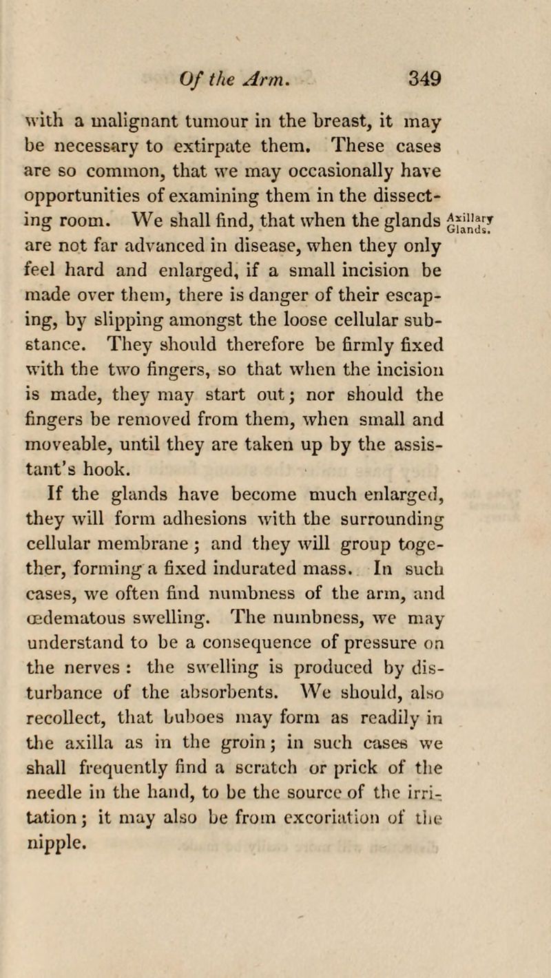 with a malignant tumour in the breast, it may¬ be necessary to extirpate them. These cases are so common, that we may occasionally have opportunities of examining them in the dissect¬ ing room. We shall find, that when the glands are not far advanced in disease, when they only feel hard and enlarged, if a small incision be made over them, there is danger of their escap¬ ing, by slipping amongst the loose cellular sub¬ stance. They should therefore be firmly fixed with the two fingers, so that when the incision is made, they may start out; nor should the fingers be removed from them, when small and moveable, until they are taken up by the assis¬ tant’s hook. If the glands have become much enlarged, they will form adhesions with the surrounding cellular membrane ; and they will group toge¬ ther, forming a fixed indurated mass. In such cases, we often find numbness of the arm, and cedematous swelling. The numbness, we may understand to be a consequence of pressure on the nerves : the swelling is produced by dis¬ turbance of the absorbents. We should, also recollect, that buboes may form as readily in the axilla as in the groin; in such cases we shall frequently find a scratch or prick of the needle in the hand, to be the source of the irri¬ tation ; it may also be from excoriation of the nipple.