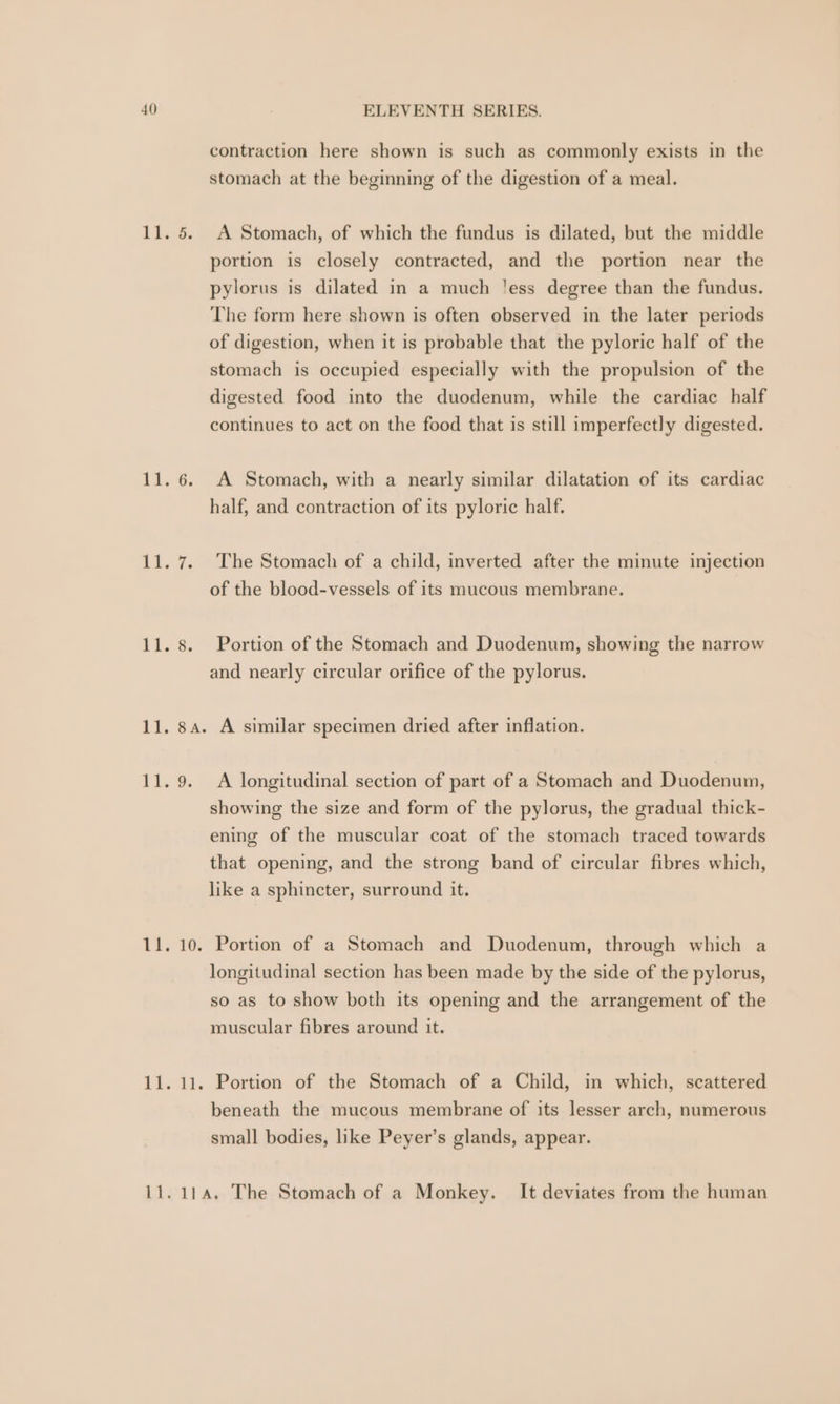 1k, 4, 11. 8. ai, 10, 1st, contraction here shown is such as commonly exists in the stomach at the beginning of the digestion of a meal. A Stomach, of which the fundus is dilated, but the middle portion is closely contracted, and the portion near the pylorus is dilated in a much !ess degree than the fundus. The form here shown is often observed in the later periods of digestion, when it is probable that the pyloric half of the stomach is occupied especially with the propulsion of the digested food into the duodenum, while the cardiac half continues to act on the food that is still imperfectly digested. A Stomach, with a nearly similar dilatation of its cardiac half, and contraction of its pyloric half. The Stomach of a child, inverted after the minute injection of the blood-vessels of its mucous membrane. Portion of the Stomach and Duodenum, showing the narrow and nearly circular orifice of the pylorus. A similar specimen dried after inflation. A longitudinal section of part of a Stomach and Duodenum, showing the size and form of the pylorus, the gradual thick- ening of the muscular coat of the stomach traced towards that opening, and the strong band of circular fibres which, like a sphincter, surround it. Portion of a Stomach and Duodenum, through which a longitudinal section has been made by the side of the pylorus, so as to show both its opening and the arrangement of the muscular fibres around it. Portion of the Stomach of a Child, in which, scattered beneath the mucous membrane of its lesser arch, numerous small bodies, like Peyer’s glands, appear.