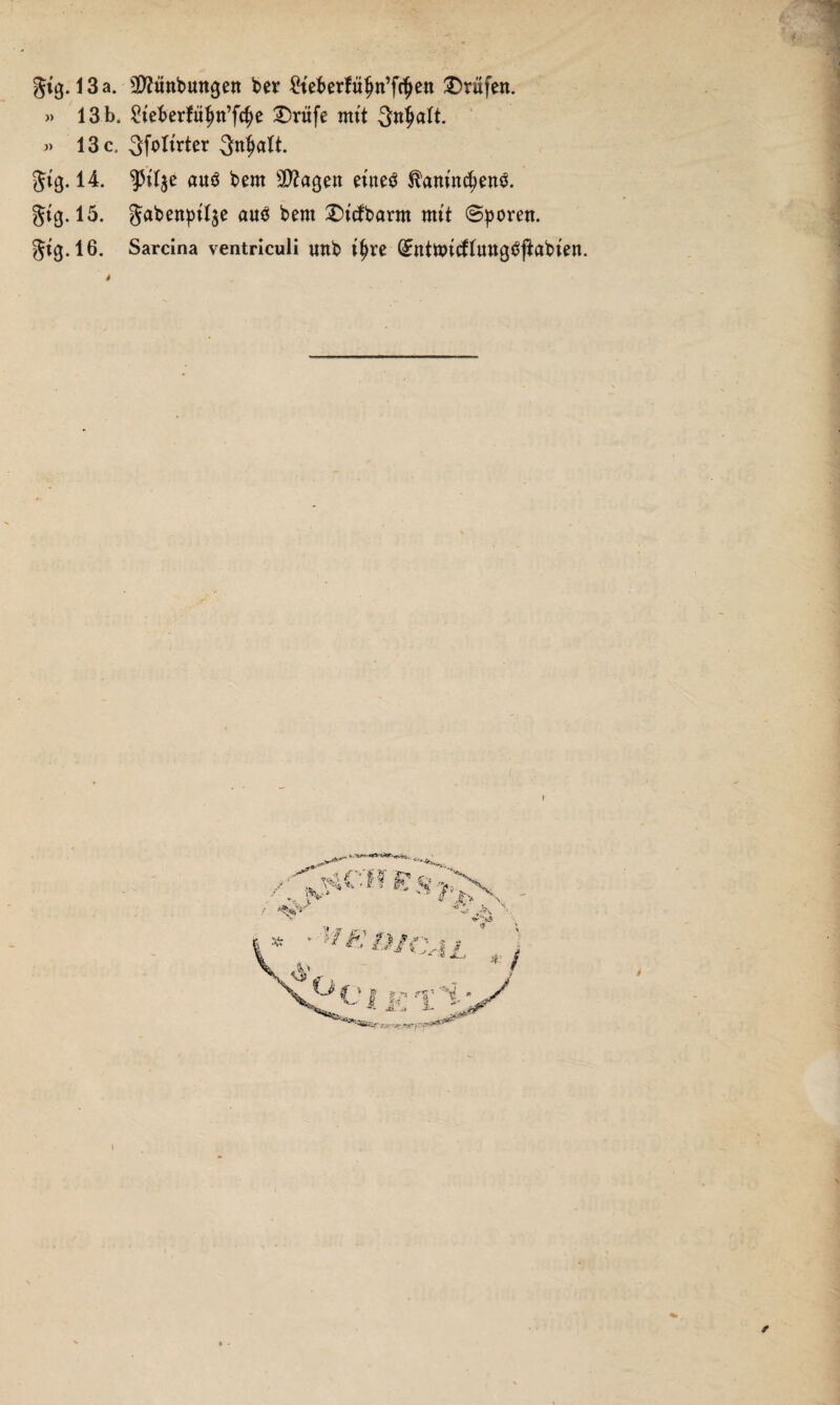 » 13 b. Steberfüjw’fc^ £)rüfe mit » 13 c, 5foIirter 3nt)alt. Jtg. 14. ^tlje auö bem Stagen etneä ^amncfyenä. gtg. 15. gabenptlje au$ bern £)tcfbarm mit Sporen. 3^.16. Sarcina ventriculi unb t^re (£ntttucflung£j?abten. \