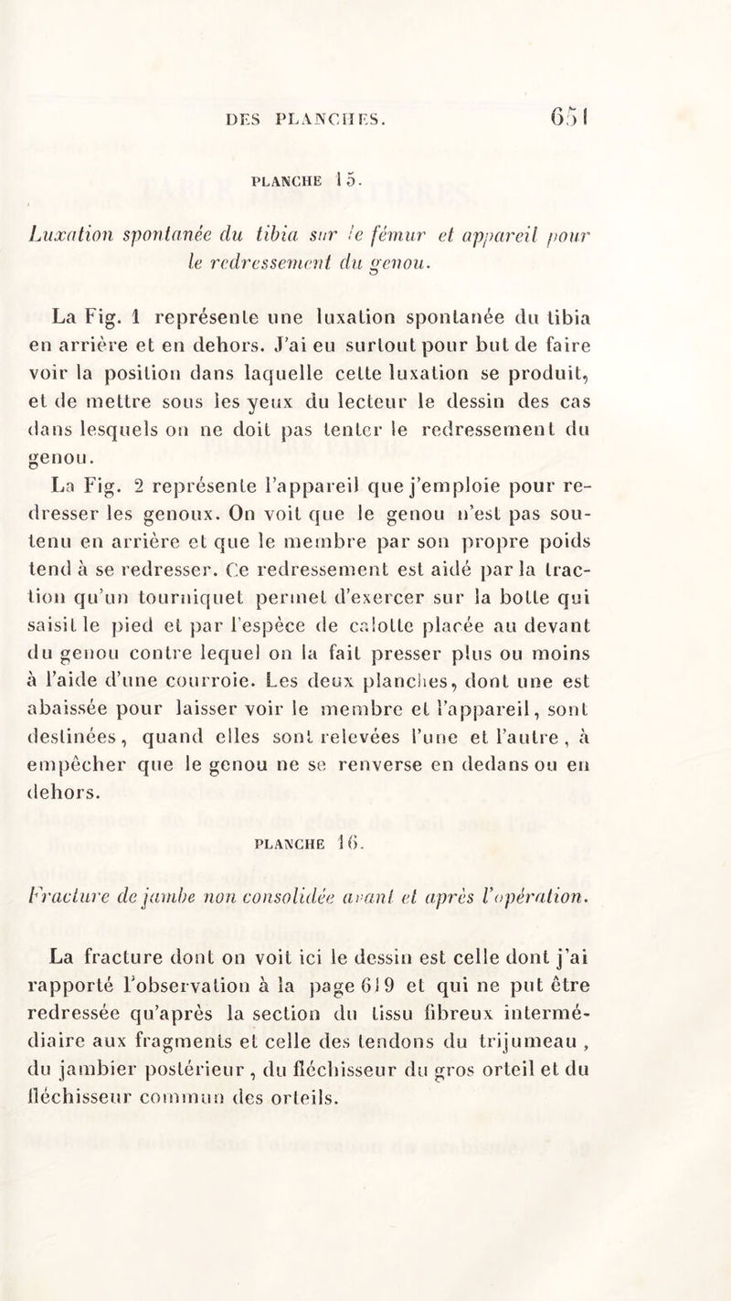 PLANCHE 15. Luxation spontanée du tibia sur le fémur et appareil pour le redressement du genou. La Fig. 1 représente une luxation spontanée du tibia en arrière et en dehors. J’ai eu surtout pour but de faire voir la position dans laquelle cette luxation se produit, et de mettre sous les yeux du lecteur le dessin des cas dans lesquels on ne doit pas tenter le redressement du genou. La Fig. 2 représente l’appareil que j’emploie pour re- dresser les genoux. On voit que le genou n’est pas sou- tenu en arrière et que le membre par son propre poids tend à se redresser. Ce redressement est aidé parla trac- tion qu’un tourniquet permet d’exercer sur la botte qui saisit le pied et par l’espèce de calotte placée au devant du genou contre lequel on la fait presser plus ou moins à l’aide d’une courroie. Les deux planches, dont une est abaissée pour laisser voir le membre et l’appareil, sont destinées, quand elles sont relevées l’une et l’autre, à empêcher que le genou ne se renverse en dedans ou en dehors. planche 16. Fracture de jambe non consolidée avant et après Vopération. La fracture dont on voit ici le dessin est celle dont j’ai rapporté l'observation à la page 619 et qui ne put être redressée qu’après la section du tissu fibreux intermé- diaire aux fragments et celle des tendons du trijumeau , du jambier postérieur , du fléchisseur du gros orteil et du fléchisseur commun des orteils.